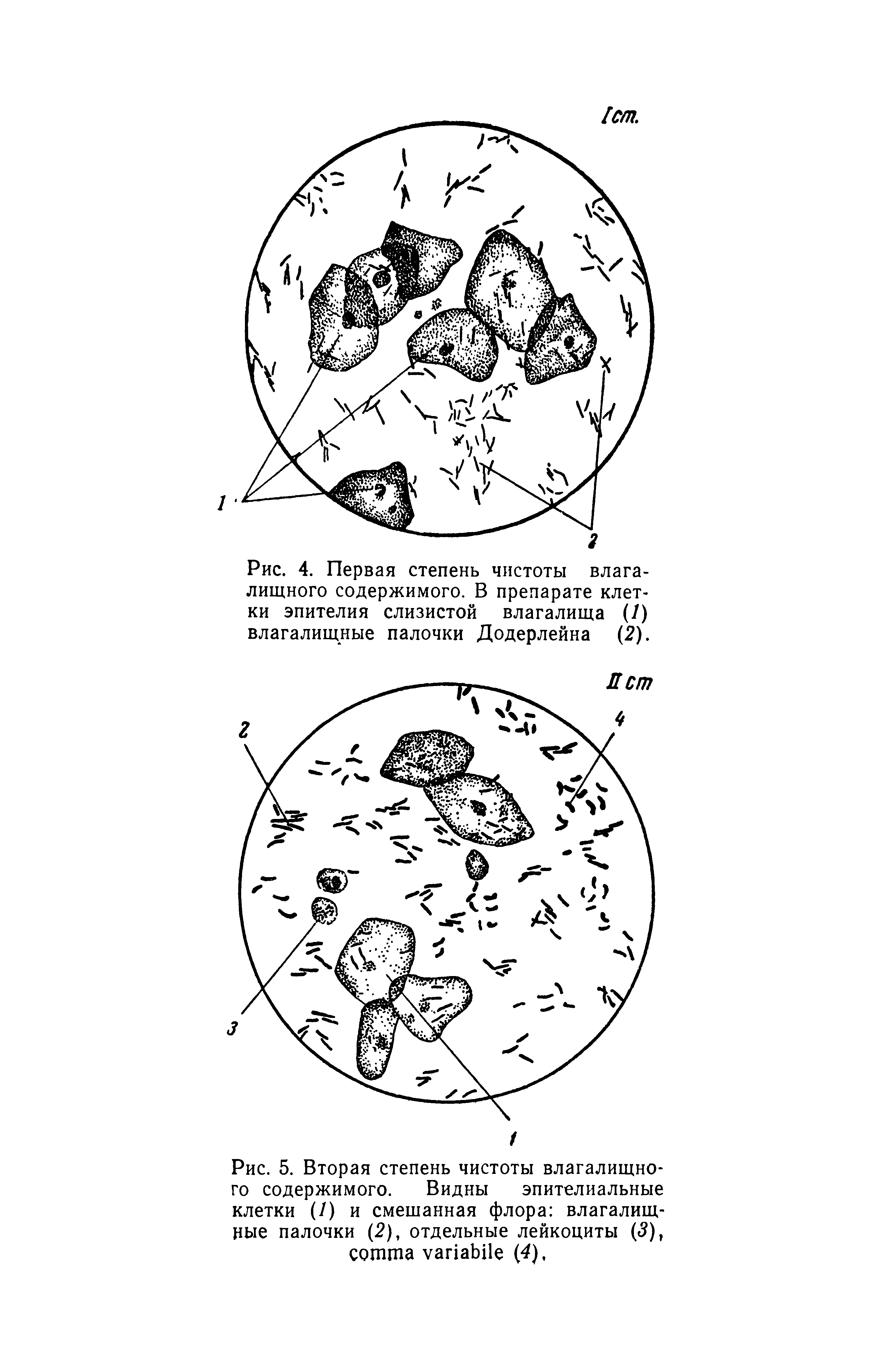 Рис. 5. Вторая степень чистоты влагалищного содержимого. Видны эпителиальные клетки (/) и смешанная флора влагалищные палочки (2), отдельные лейкоциты (5), (4).