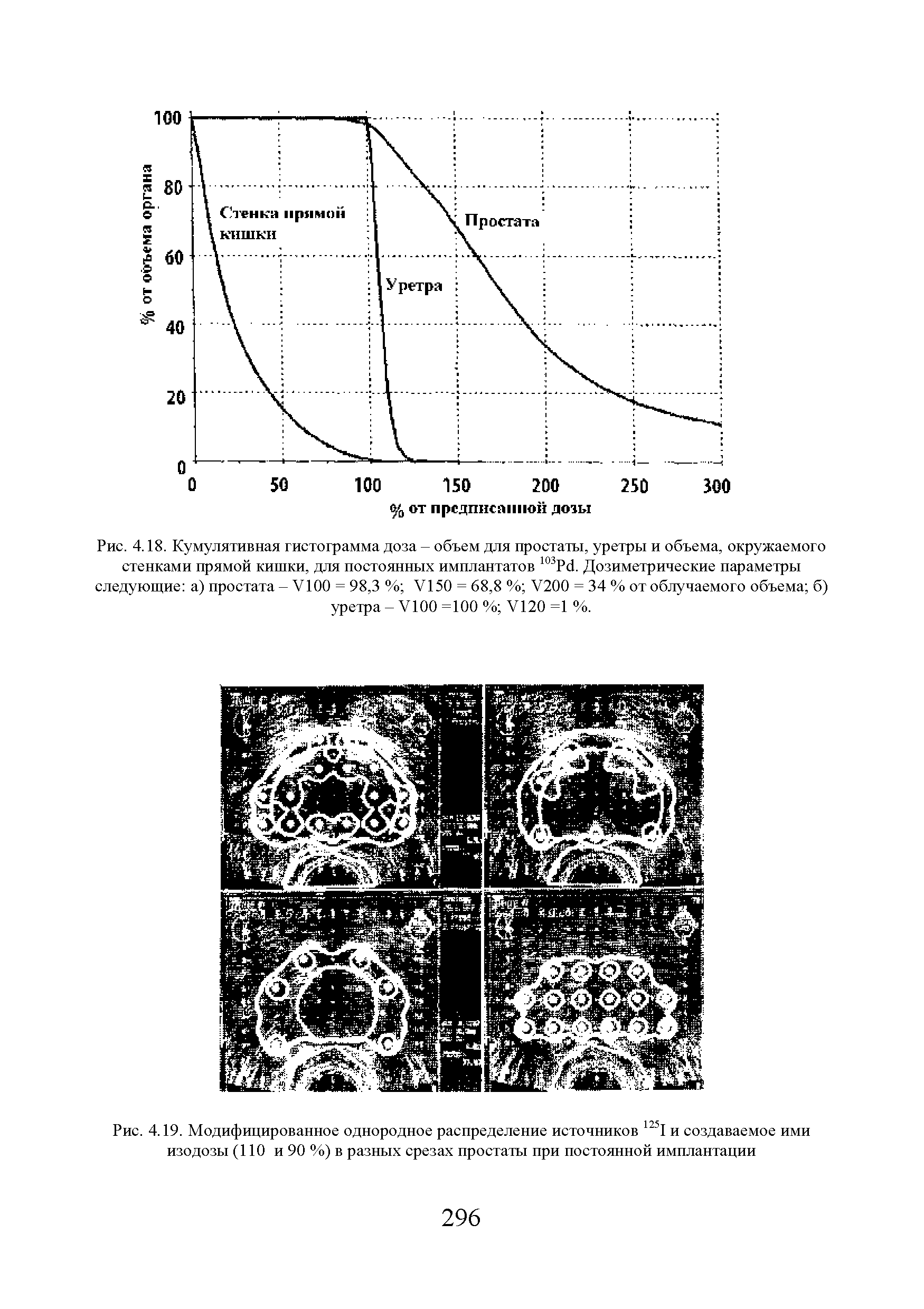 Рис. 4.18. Кумулятивная гистограмма доза - объем для простаты, уретры и объема, окружаемого стенками прямой кишки, для постоянных имплантатов 103Рс1. Дозиметрические параметры следующие а) простата - У100 = 98,3 % У150 = 68,8 % У200 = 34 % от облучаемого объема б) уретра - У100 =100 % У120 =1 %.