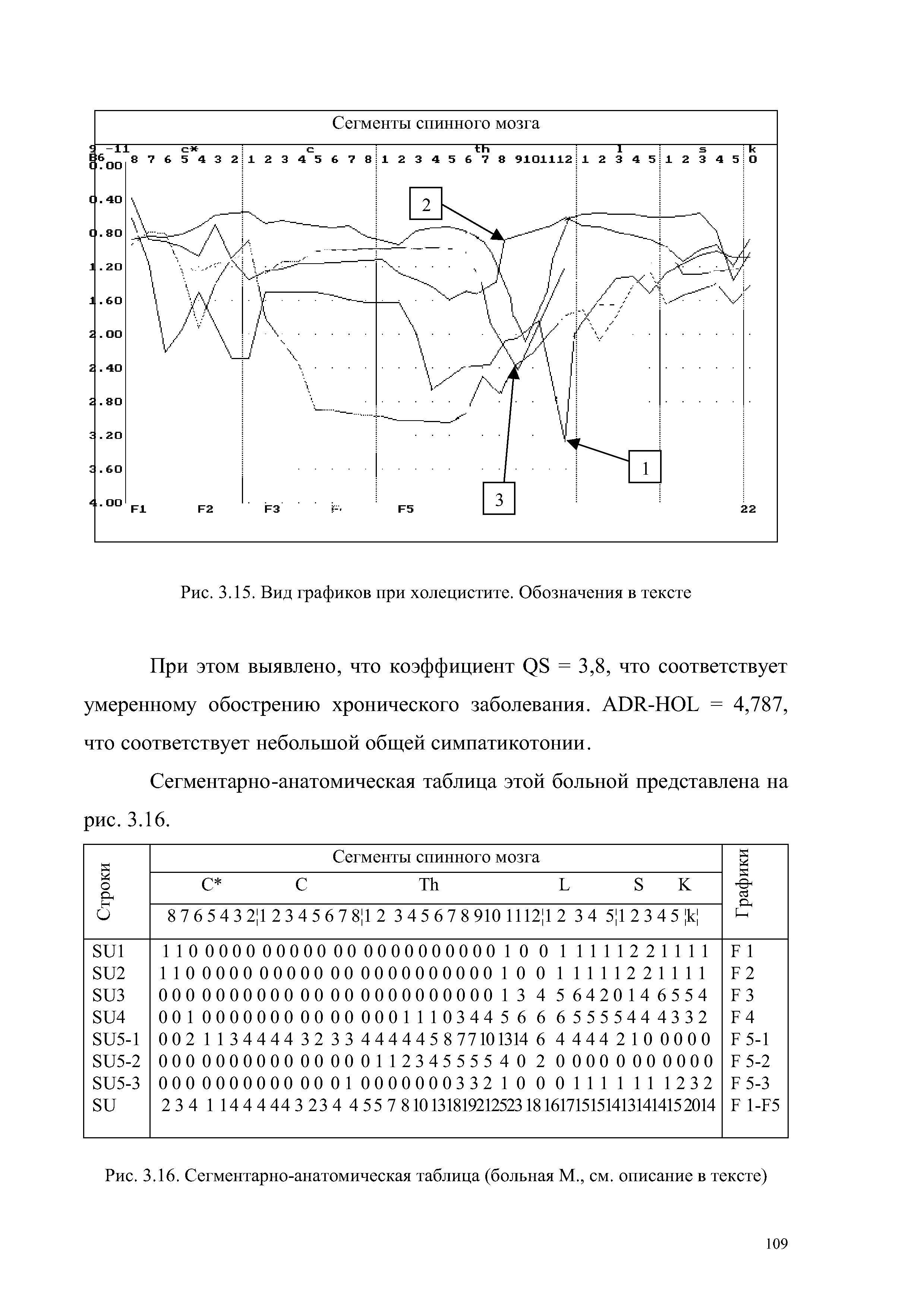 Рис. 3.16. Сегментарно-анатомическая таблица (больная М., см. описание в тексте)...