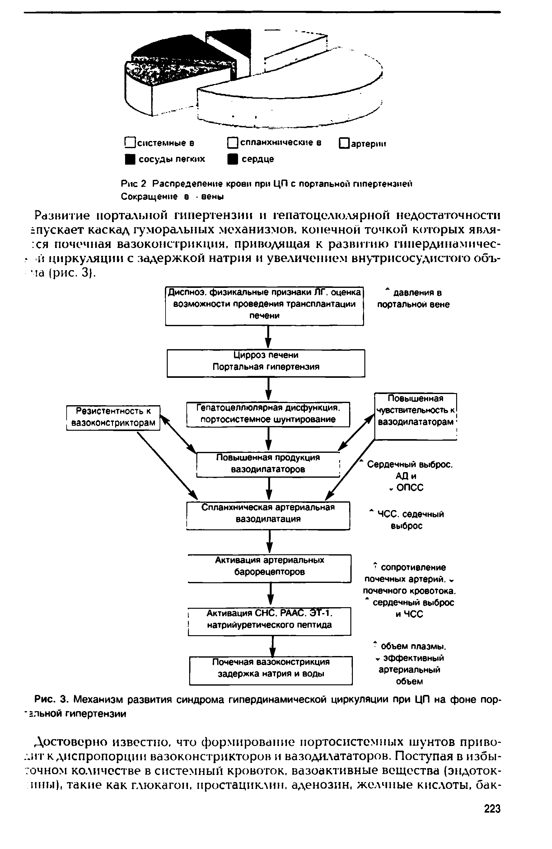 Рис. 3. Механизм развития синдрома гипердинамической циркуляции при ЦП на фоне пор-вльной гипертензии...
