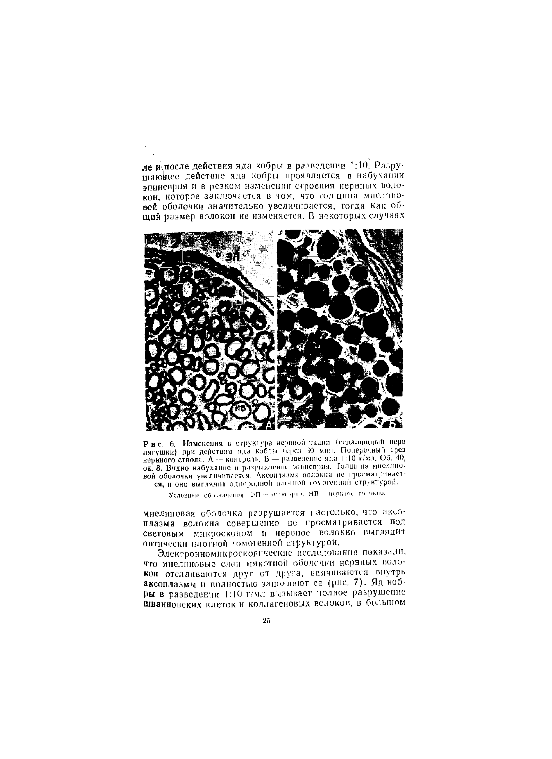 Рис. 6. Изменения о структуре неркной ткани (седалищный нерв лягушки) при дейстнии , кобры через 30 мин. Поперечный срез нервного ствола. А — контроль, Б — разведение яда 1 ]0 г/мл. Об. 40, ок. 8. Видно набухание и разрыхление эпннсорля. Толщина миелиновой оболочки увеличивает я. Аксоплазма волокна не просматривается, и оно выглядит однородной плотной гомогенной структурой.