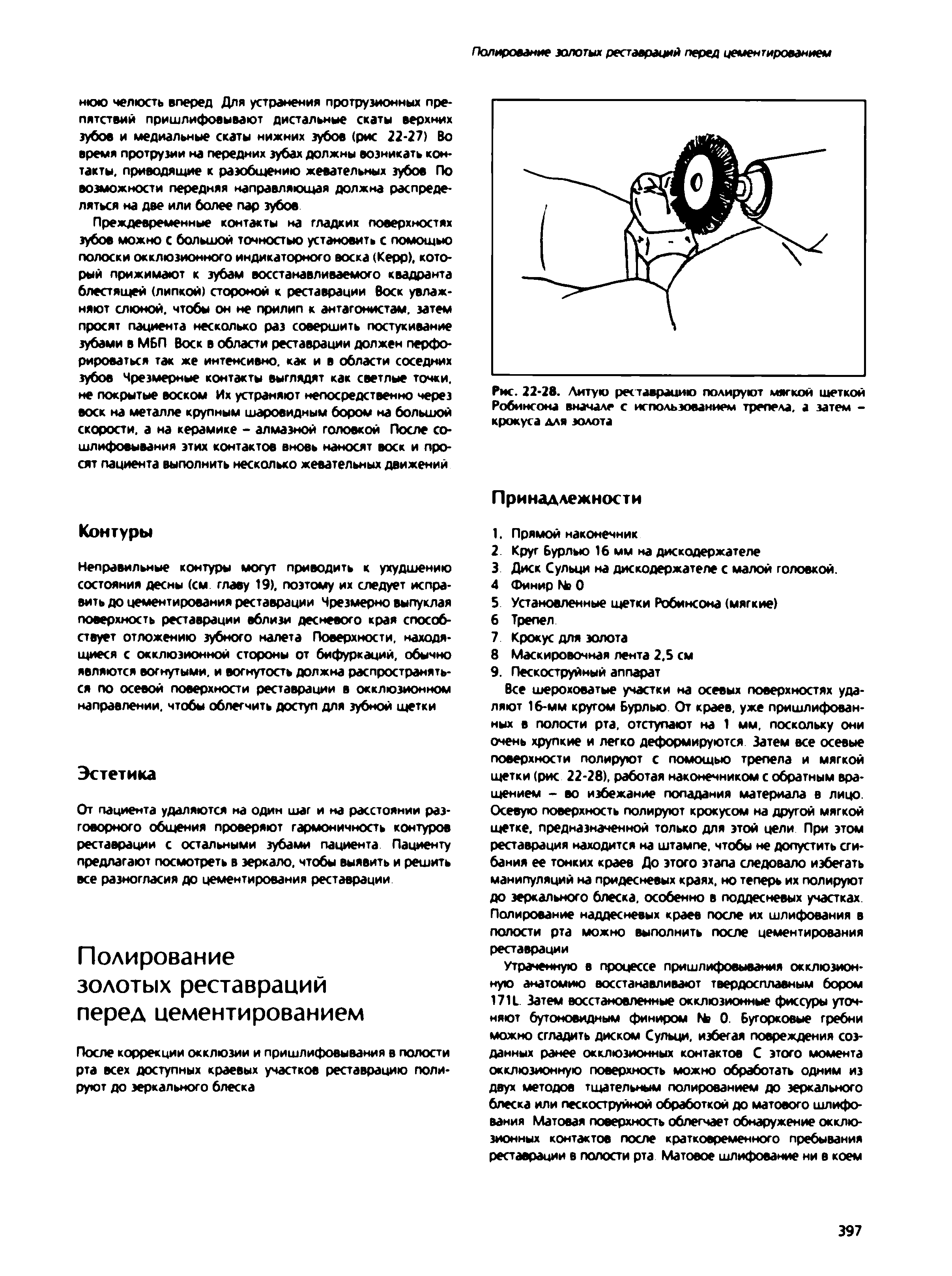 Рис. 22-28. Литую реставрацию полируют мягкой щеткой Робинсона вначале с использованием трепела, а затем -крокуса для золота...