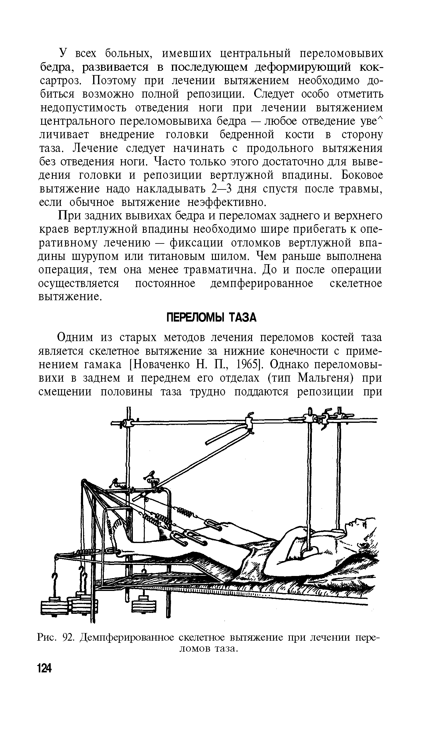 Рис. 92. Демпферированное скелетное вытяжение при лечении переломов таза.