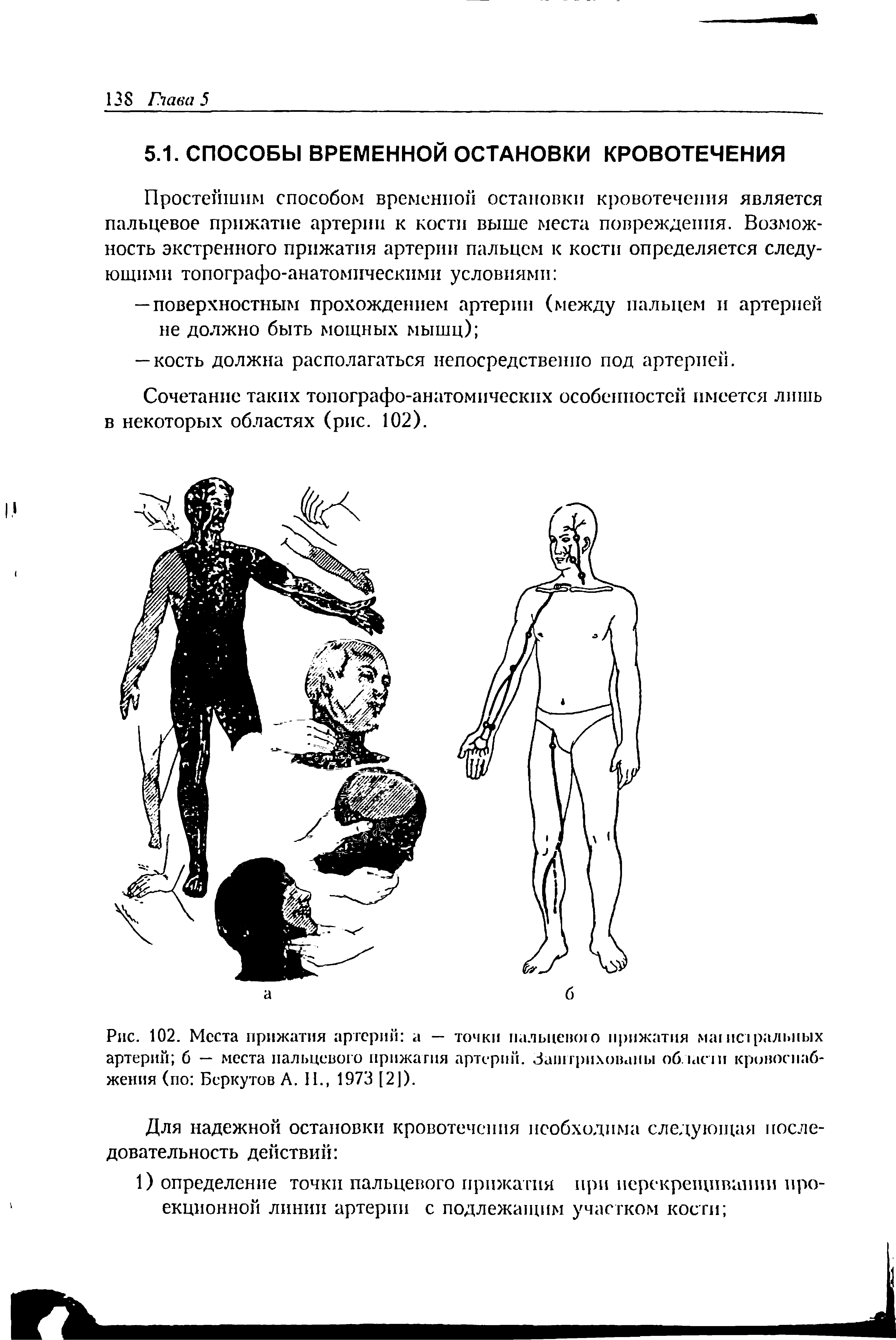 Рис. 102. Места прижатия артерий а — точки пальцевого прижатия магистральных артерий б — места пальцевого прижатия артерии. Заштрихованы облает кровоснабжения (по Беркутов А. II., 1973 [2]).