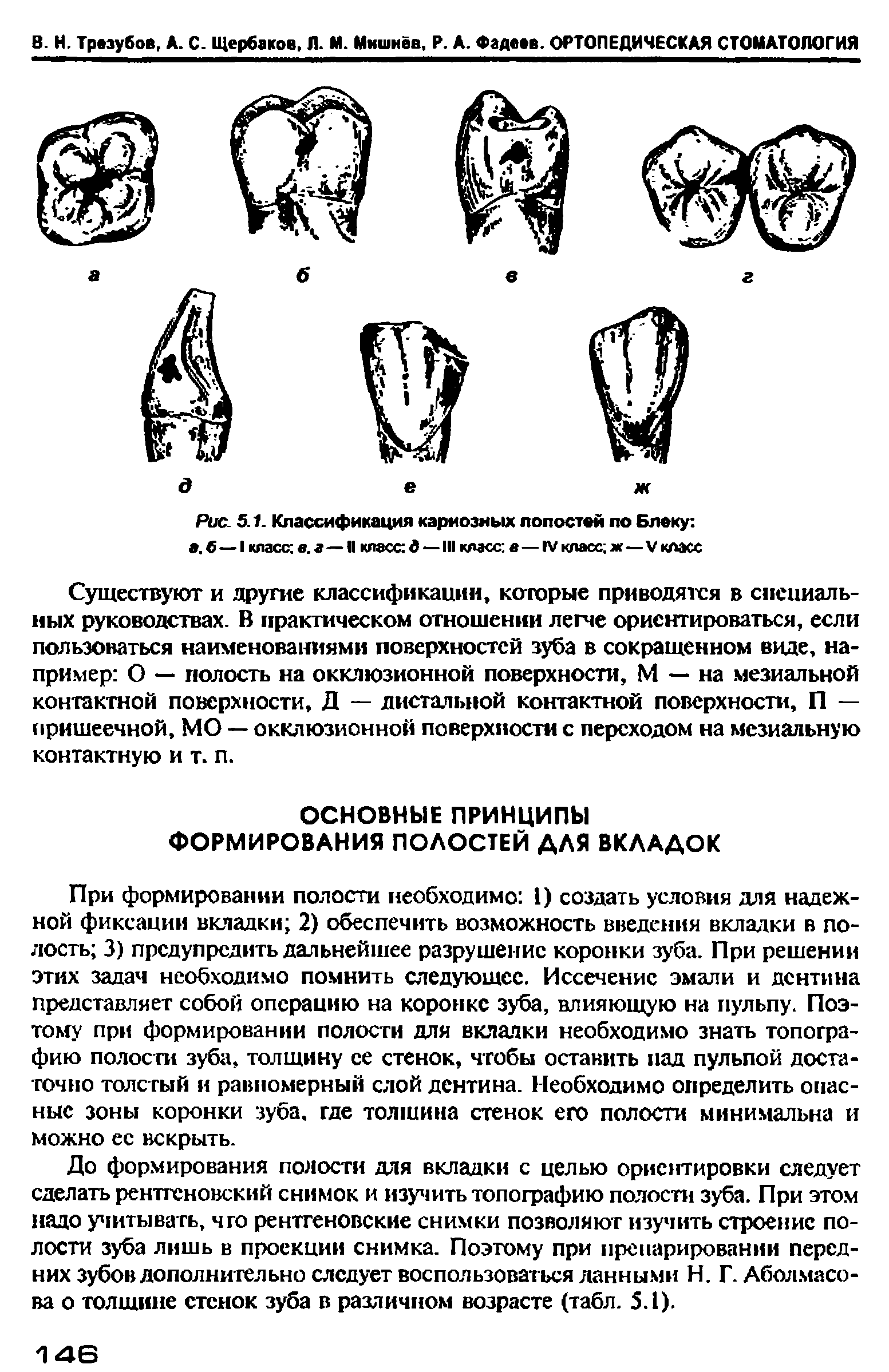 Рис. 5.1. Классификация кариозных полостей по Блоку в. 6—I класс в. а—II класс 6 — III класс в—IV класс ж—V класс...