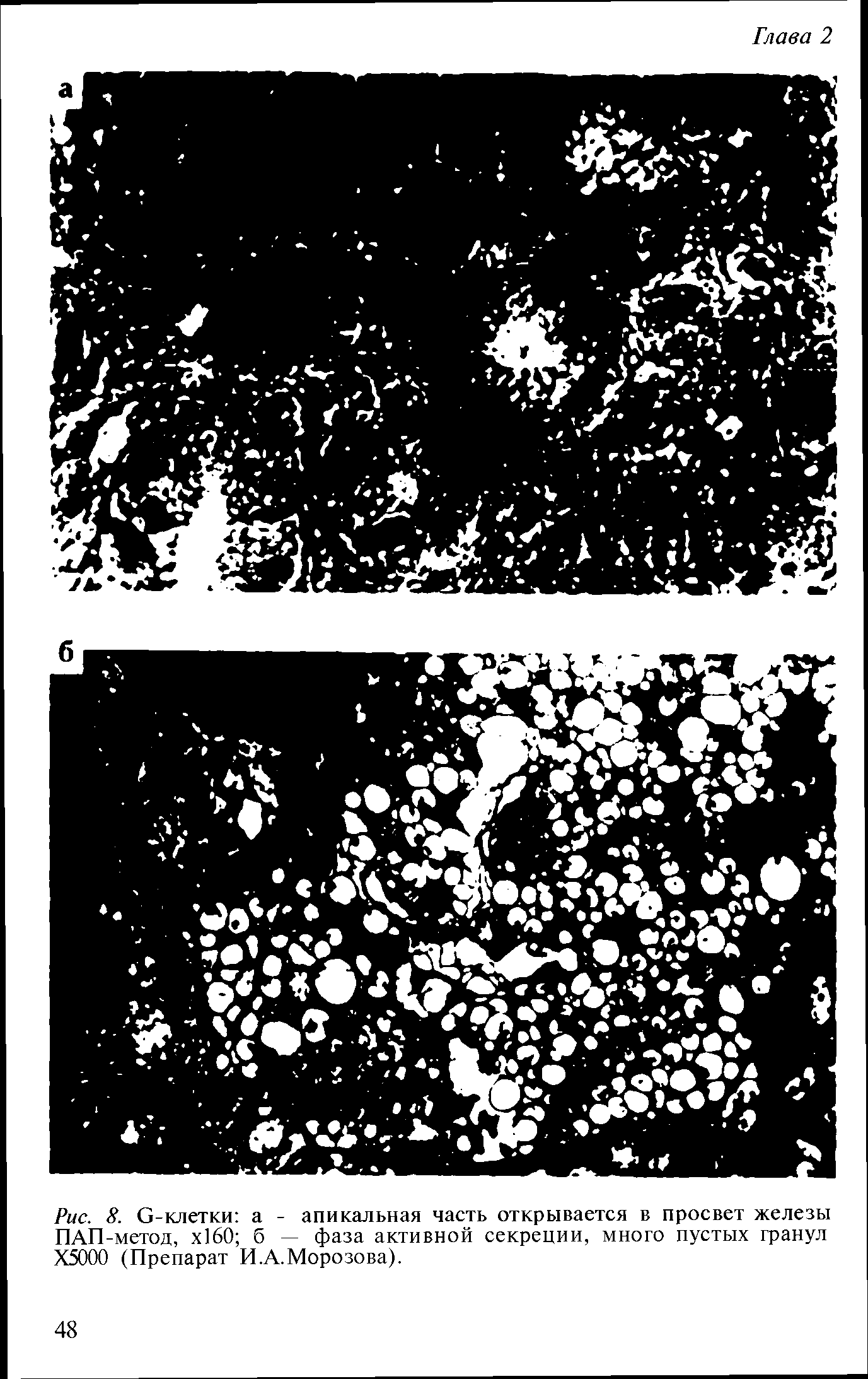Рис. 8. С-клетки а - апикальная часть открывается в просвет железы ПАП-метод, х160 б — фаза активной секреции, много пустых гранул Х5000 (Препарат И.А.Морозова).