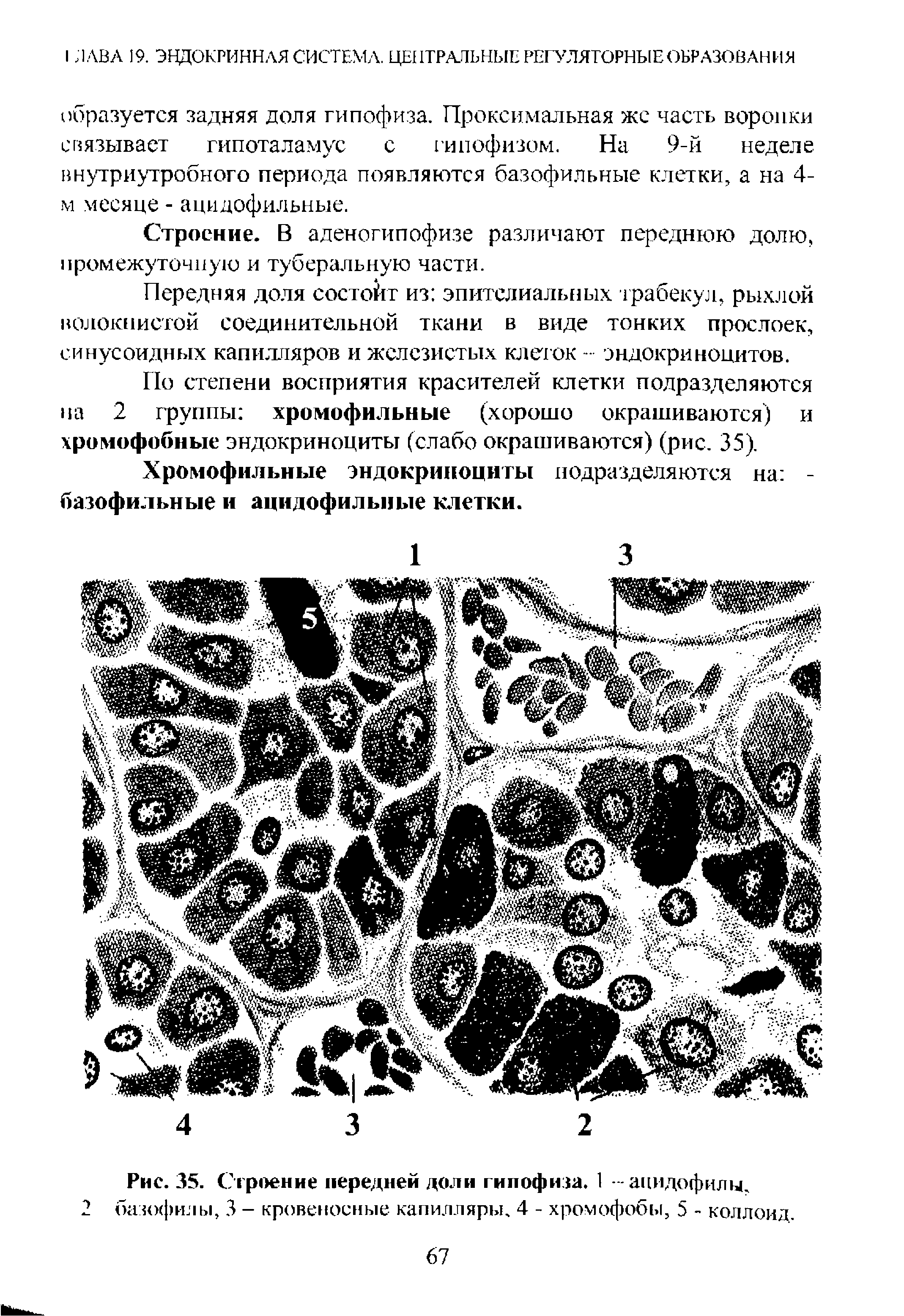 Рис. 35. Строение передней доли гипофиза. 1 ацидофилы, базофилы, 3 - кровеносные капилляры, 4 - хромофобы, 5 - коллоид.