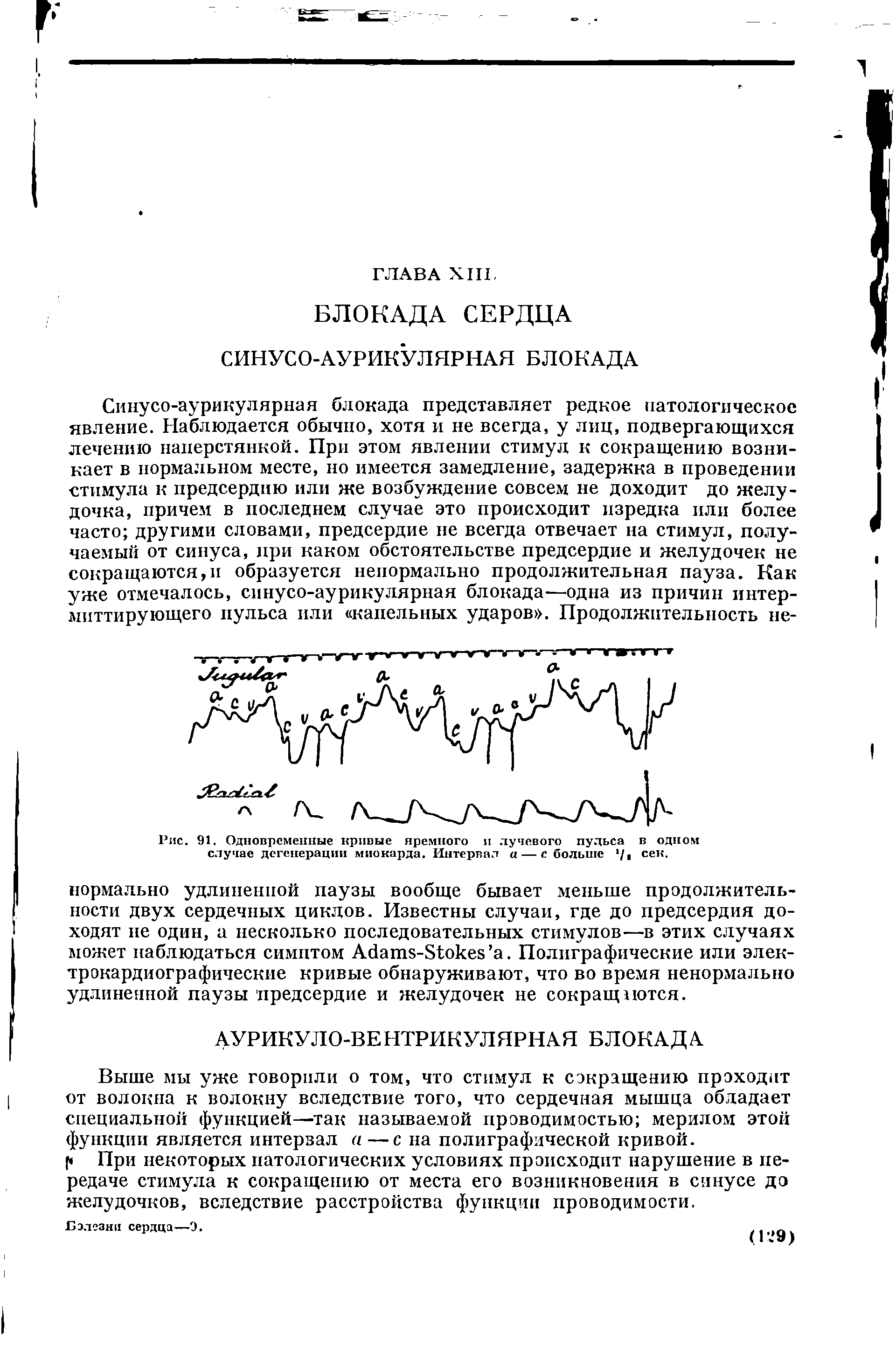 Рис. 91. Одновременные кривые премного и лучевого пульса в одном случае дегенерации миокарда. Интервал а — с больше /в сек.