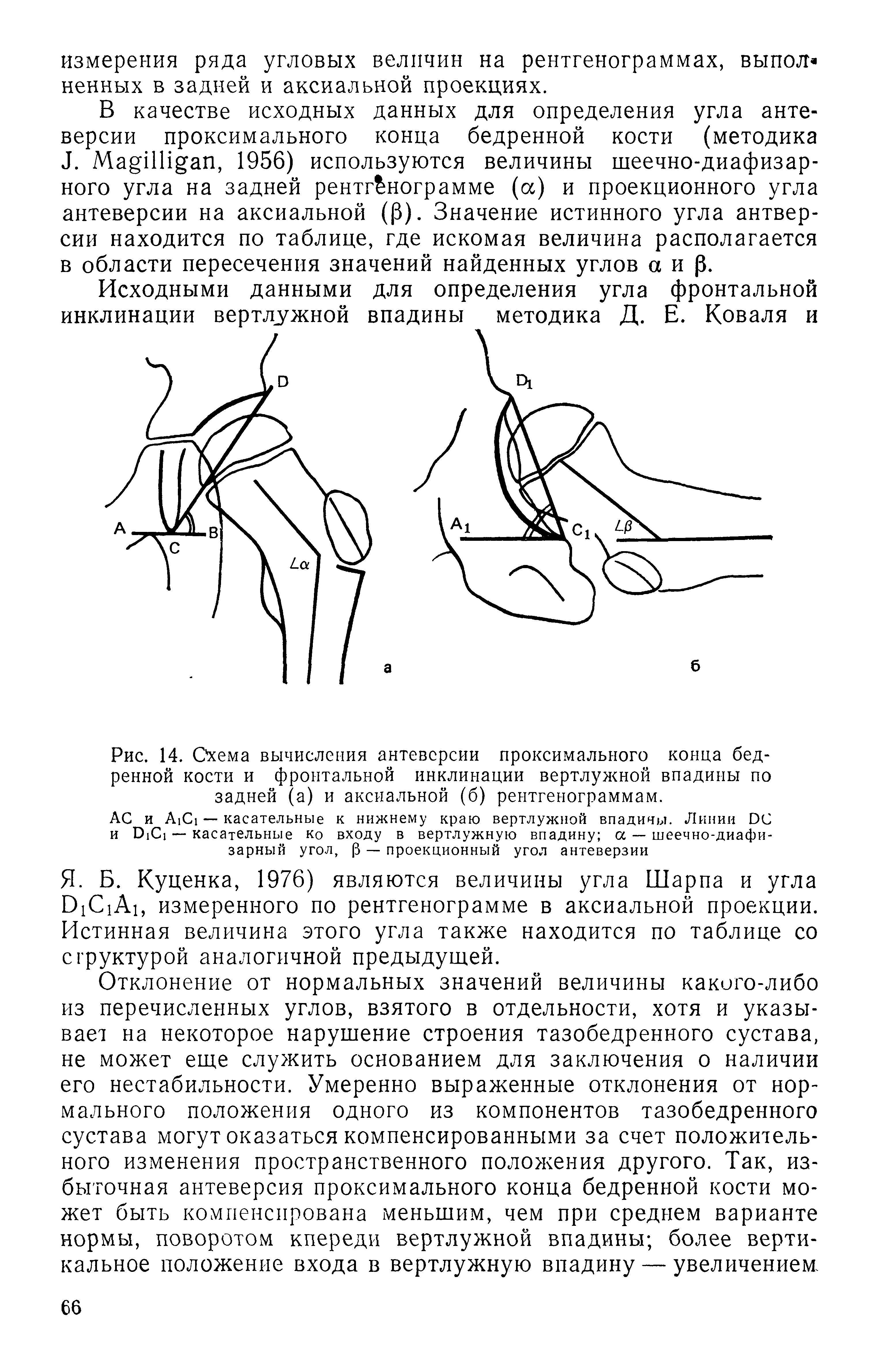 Рис. 14. Схема вычисления антеверсии проксимального конца бедренной кости и фронтальной инклинации вертлужной впадины по задней (а) и аксиальной (б) рентгенограммам.