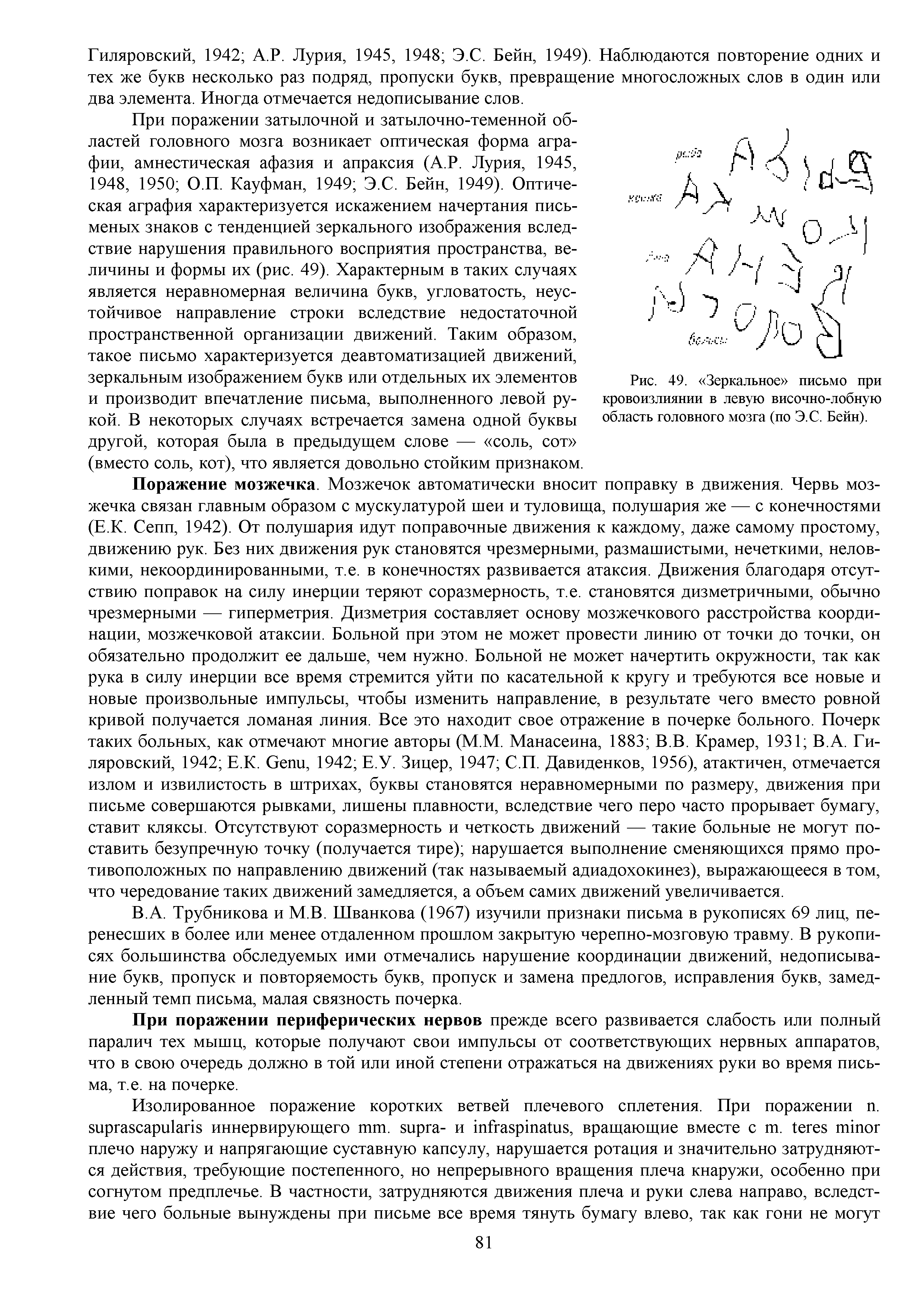 Рис. 49. Зеркальное письмо при кровоизлиянии в левую височно-лобную область головного мозга (по Э.С. Бейн).