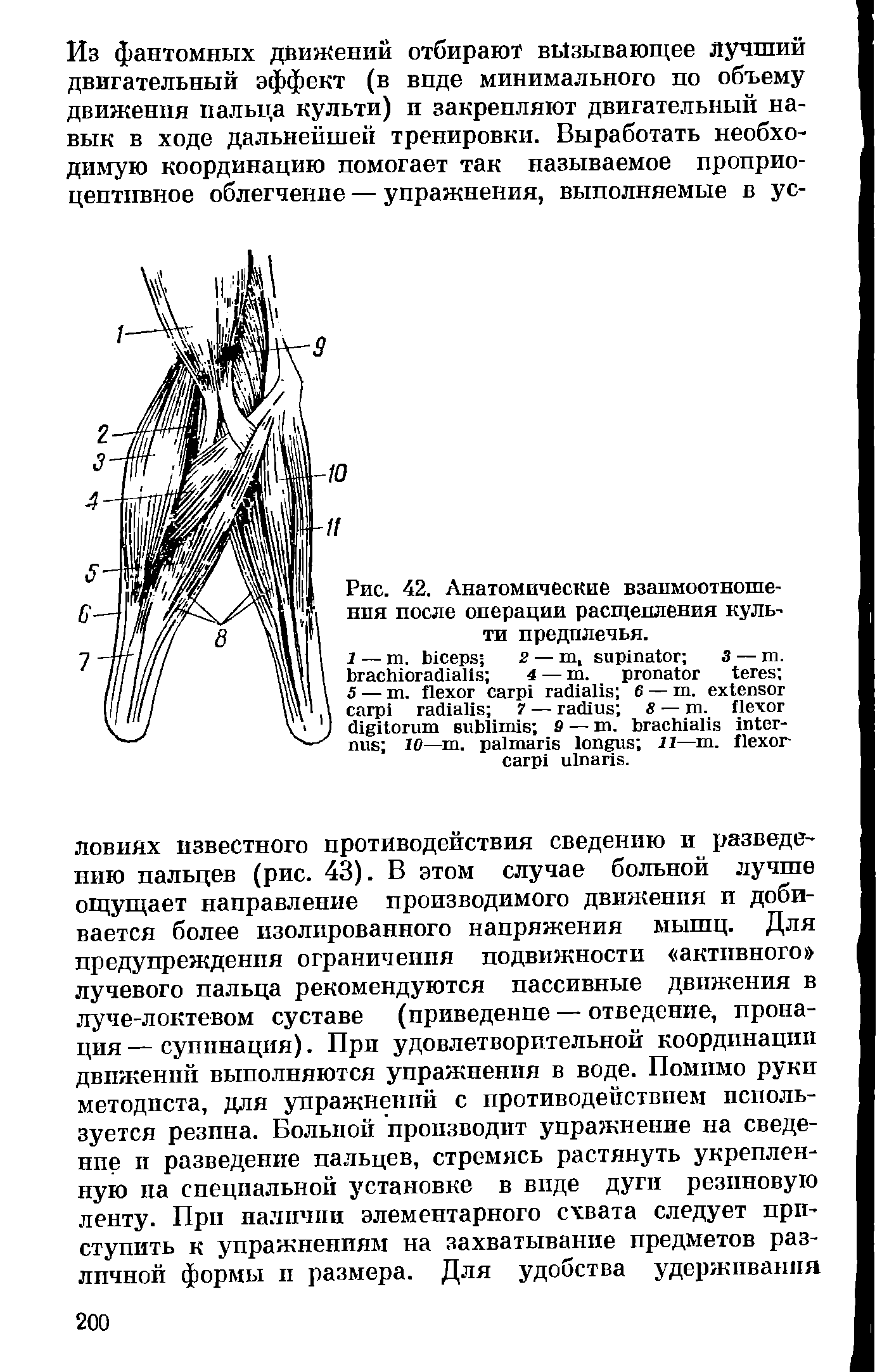 Рис. 42. Анатомические взаимоотношения после операции расщепления культи предплечья.