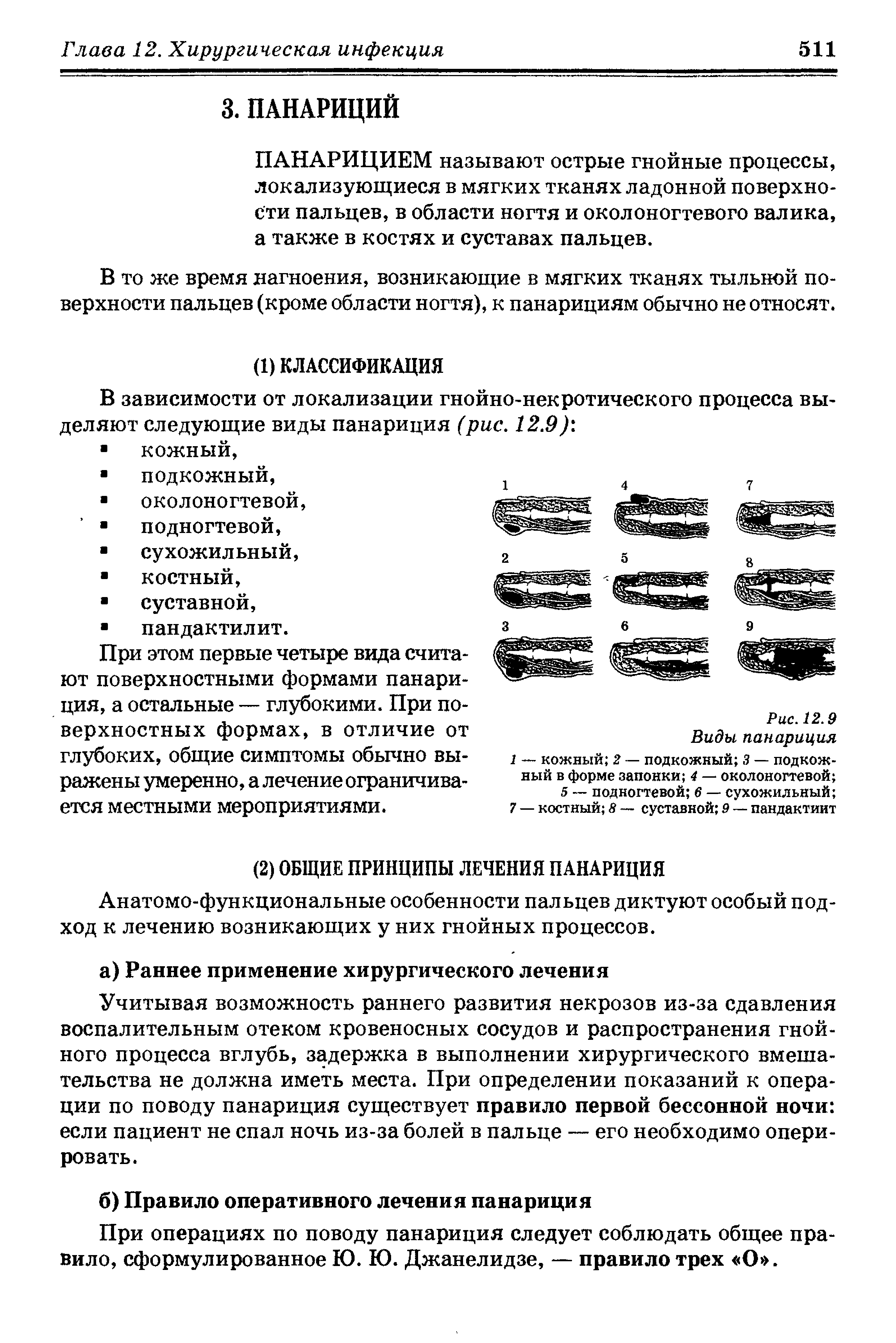 Рис. 12.9 Виды панариция 1 — кожный 2 — подкожный 3 — подкожный в форме запонки 4 — околоногтевой ...