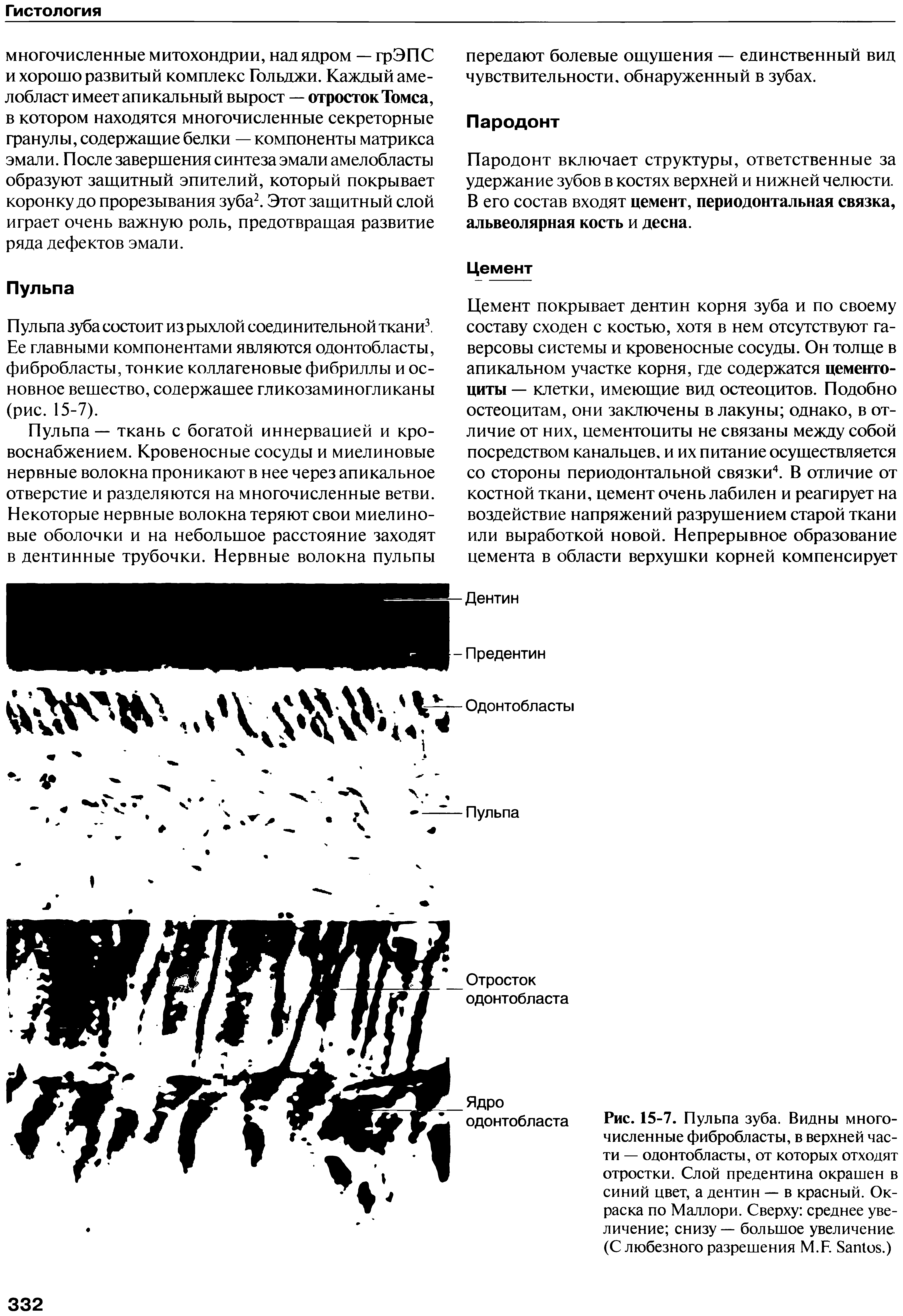 Рис. 15-7. Пульпа зуба. Видны многочисленные фибробласты, в верхней части — одонтобласты, от которых отходят отростки. Слой предентина окрашен в синий цвет, а дентин — в красный. Окраска по Маллори. Сверху среднее увеличение снизу — большое увеличение. (С любезного разрешения М.Е S .)...