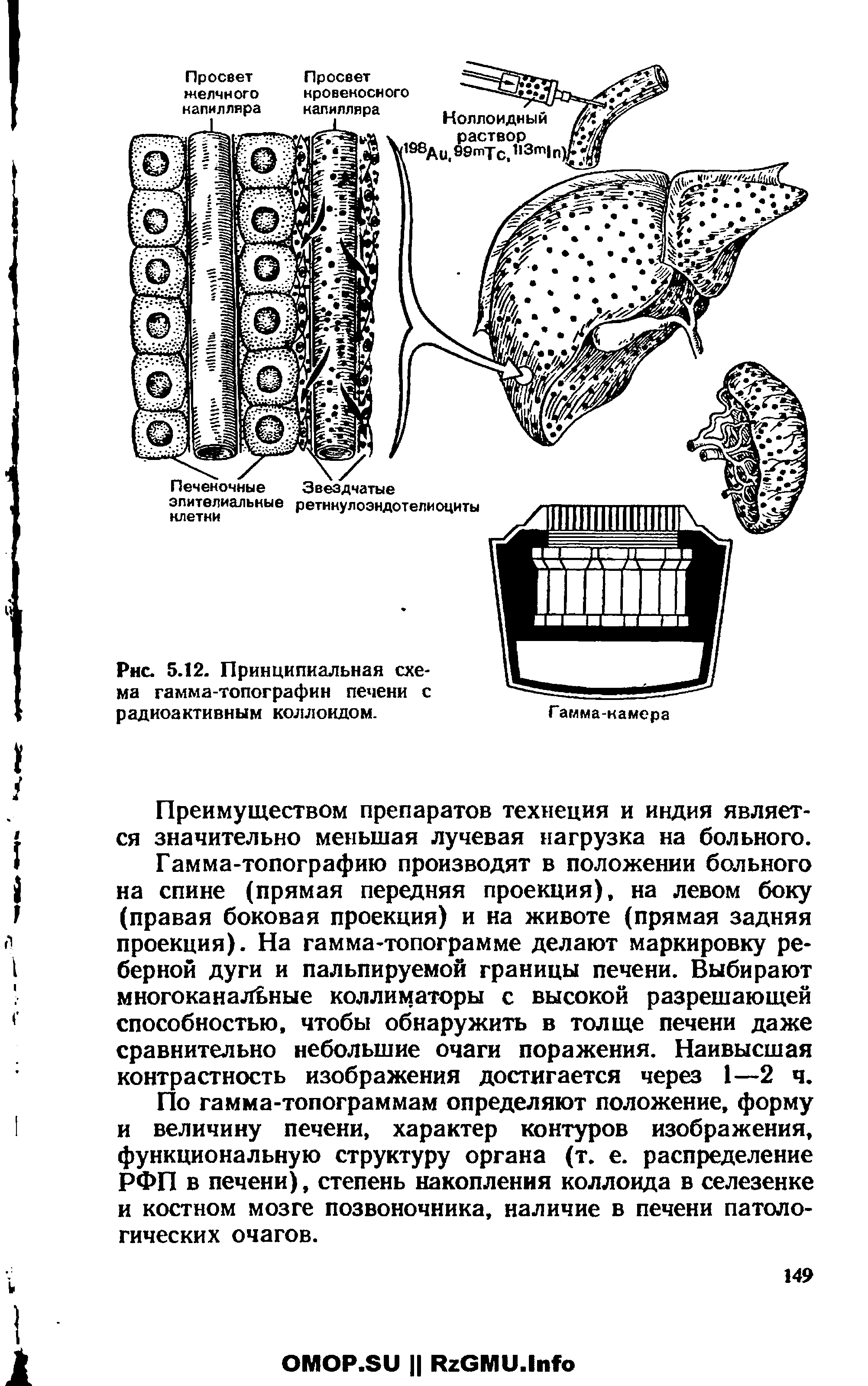 Рис. 5.12. Принципиальная схема гамма-топографии печени с радиоактивным коллоидом.