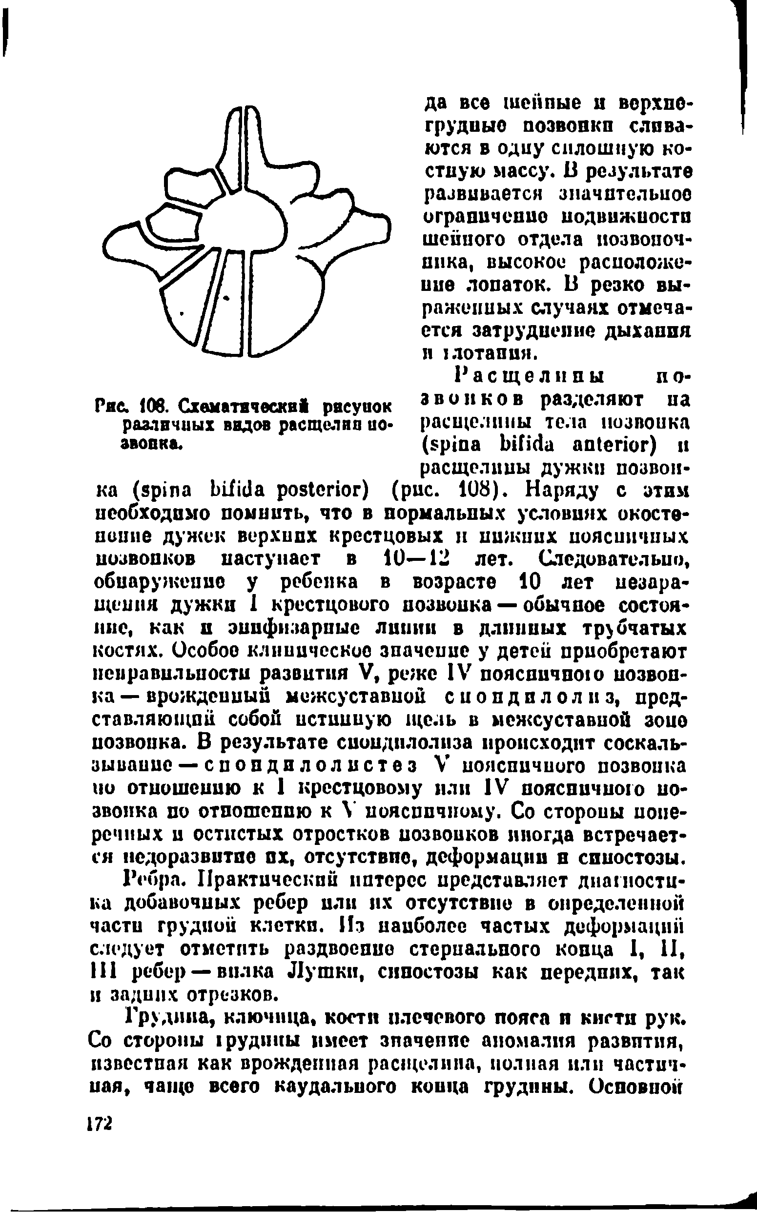 Рис. 108. Схематически рнсуиок звонков разделяют на разлвчиых видов расщелин ио- расщелины тела позвонка звонка. ( ) п...