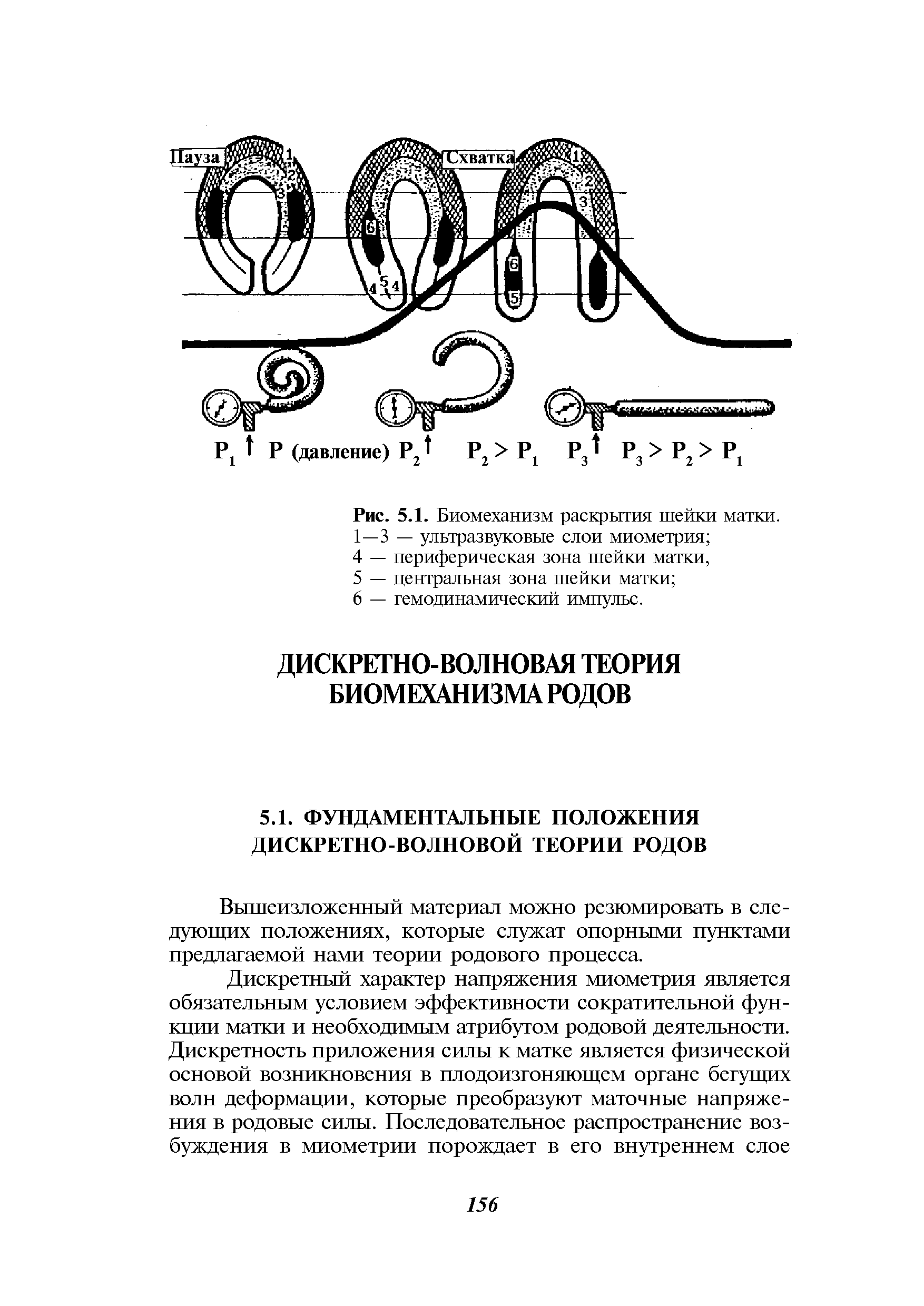 Рис. 5.1. Биомеханизм раскрытия шейки матки. 1—3 — ультразвуковые слои миометрия ...