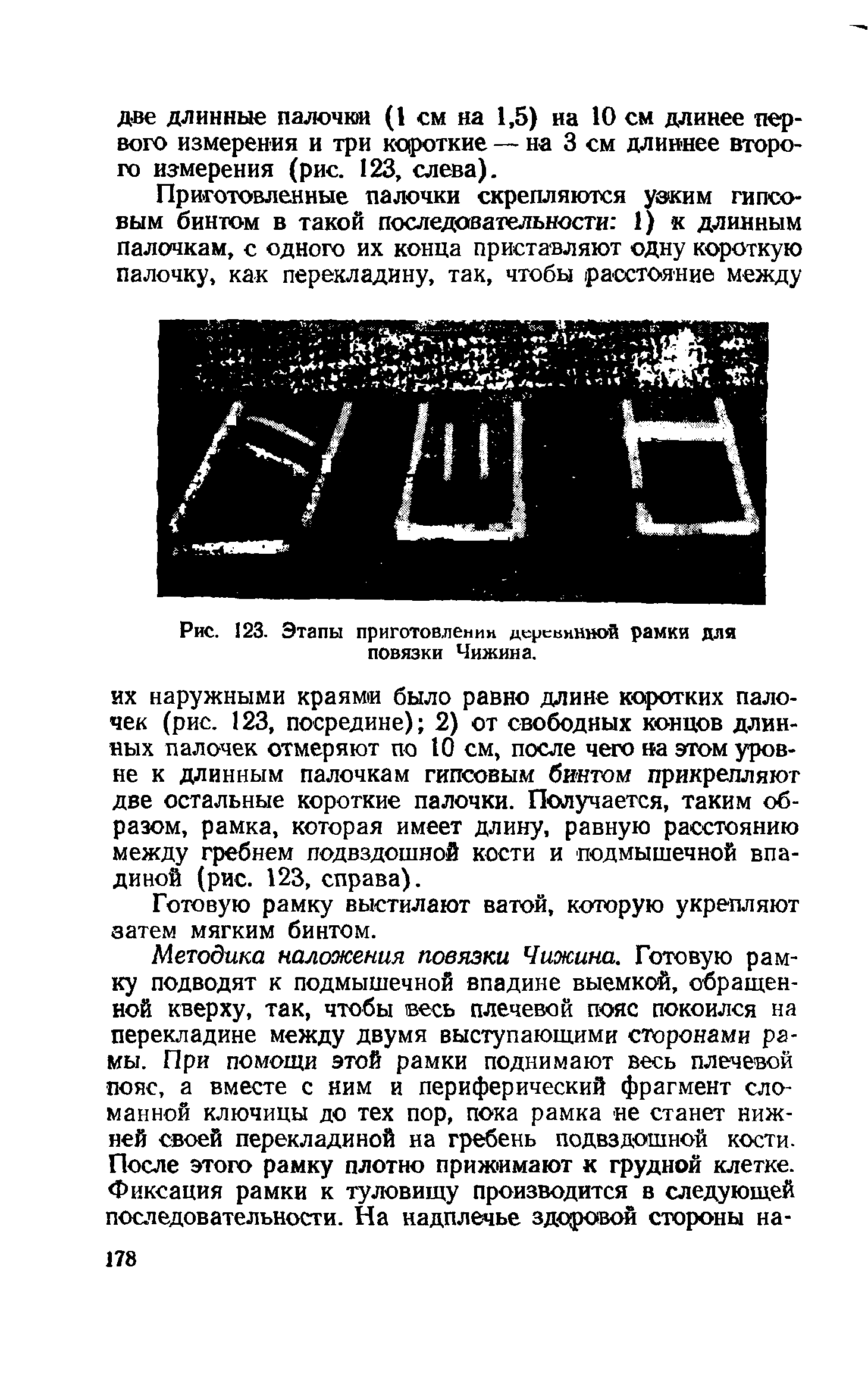 Рис. 123. Этапы приготовлении деревянной рамки для повязки Чижина.