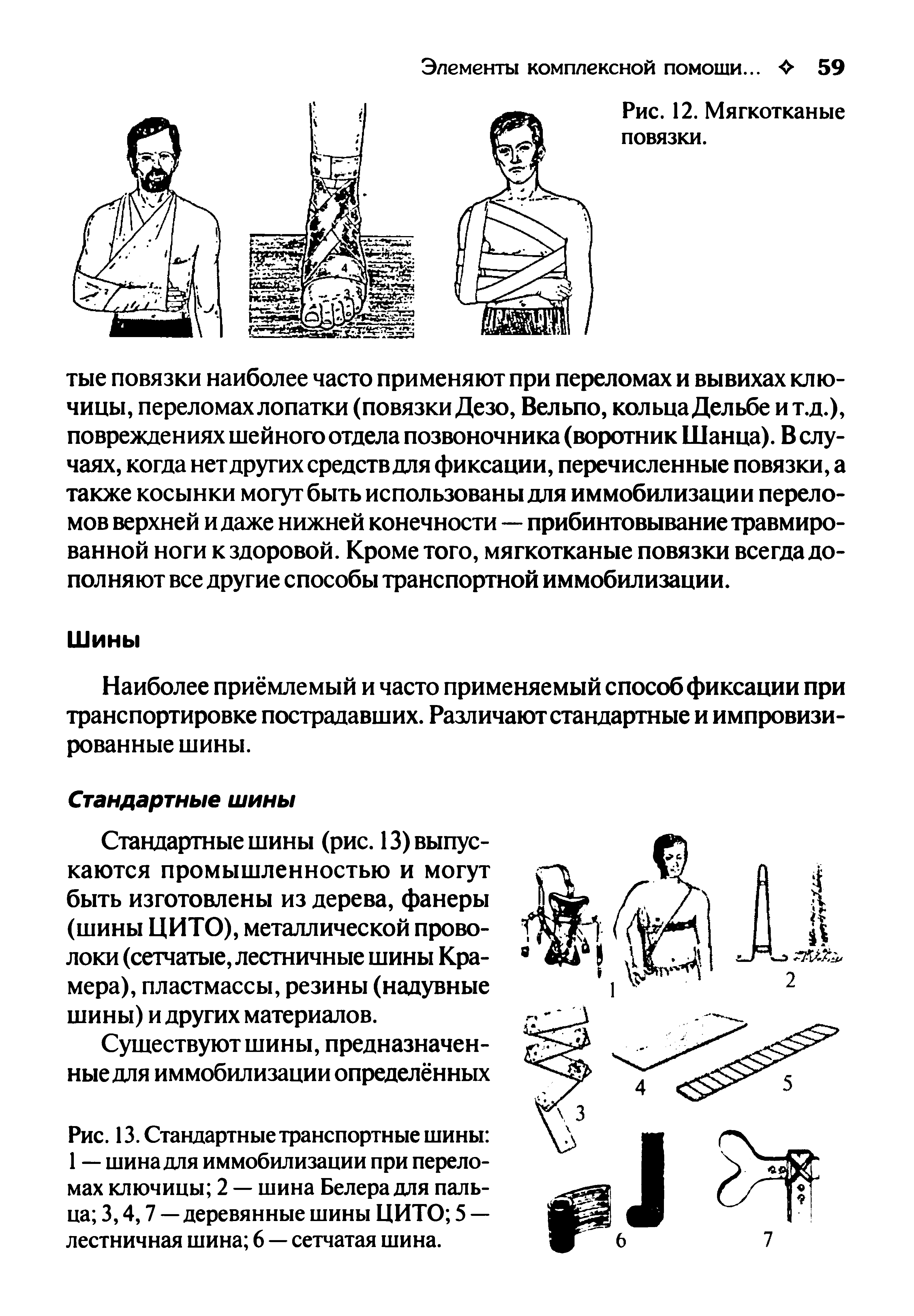 Рис. 13. Стандартные транспортные шины 1 — шина для иммобилизации при переломах ключицы 2 — шина Белера для пальца 3,4,7 — деревянные шины ЦИТО 5 — лестничная шина 6 — сетчатая шина.