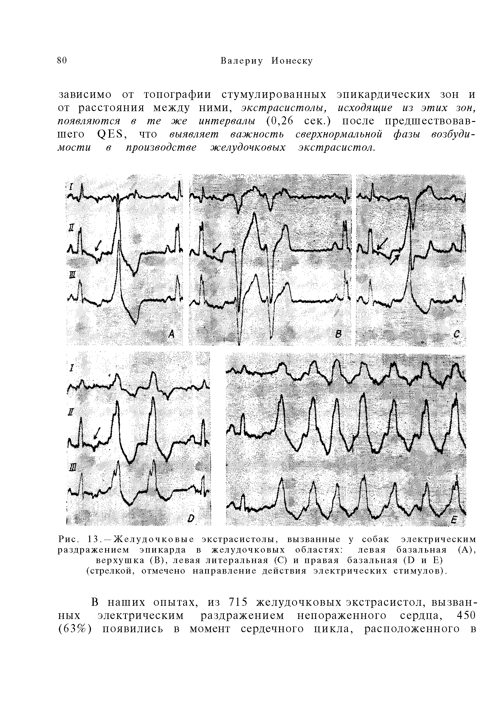 Рис. 13. — Желуд очко вы е экстрасистолы, вызванные у собак электрическим раздражением эпикарда в желудочковых областях левая базальная (А), верхушка (В), левая литеральная (С) и правая базальная (I) и Е) (стрелкой, отмечено направление действия электрических стимулов).