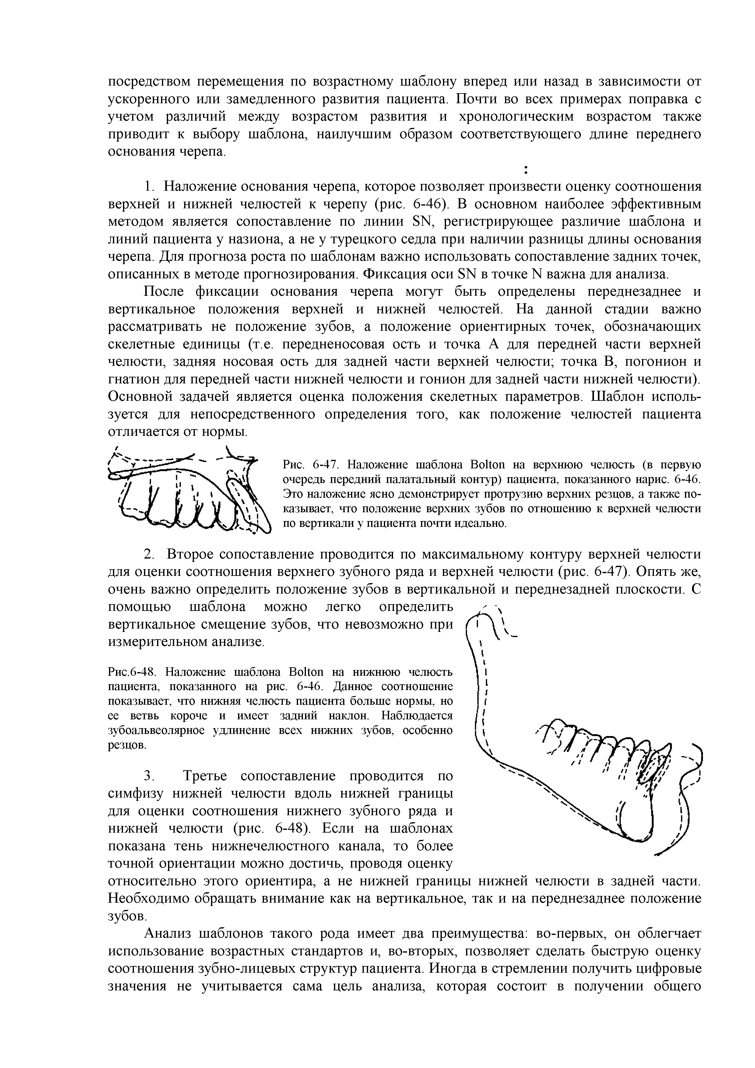 Рис.6-48. Наложение шаблона B на нижнюю челюсть пациента, показанного на рис. 6-46. Данное соотношение показывает, что нижняя челюсть пациента больше нормы, но ее ветвь короче и имеет задний наклон. Наблюдается зубоальвеолярное удлинение всех нижних зубов, особенно резцов.