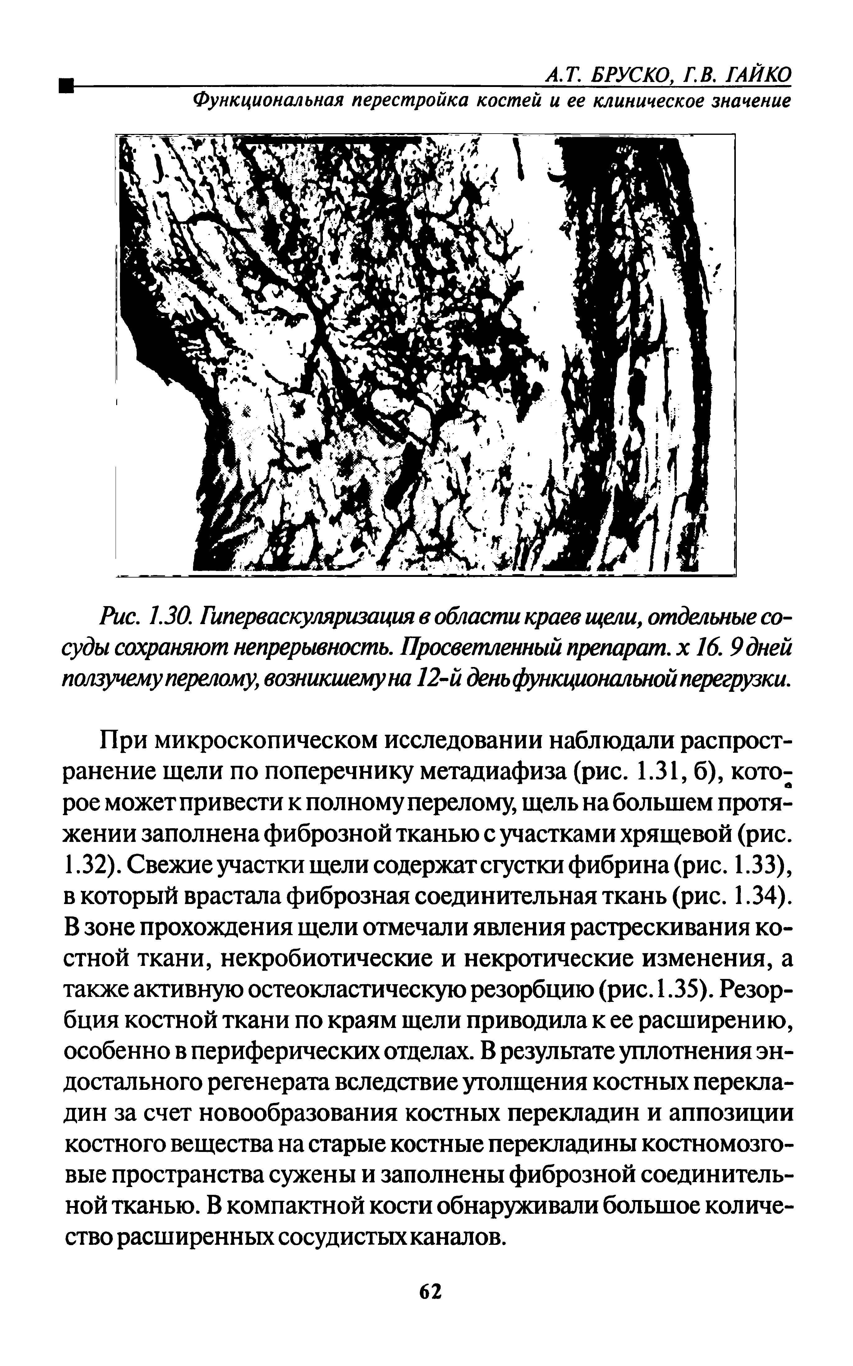 Рис. 1.30. Гиперваскуляризация в области краев щели, отдельные сосуды сохраняют непрерывность. Просветленный препарат, х 16. 9 дней ползучему перелому, возникшему на 12-й денъфункционалъной перегрузки.