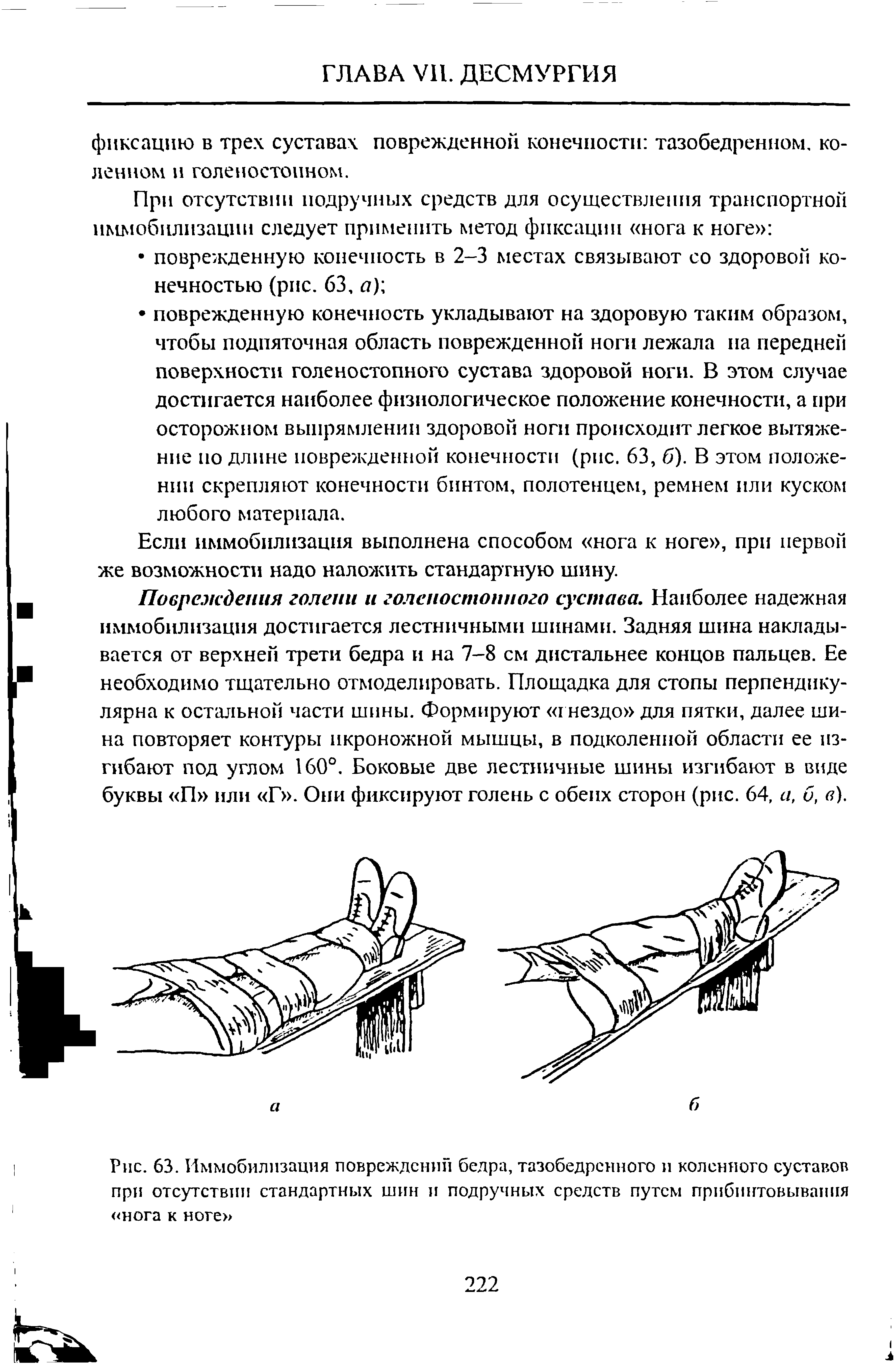 Рис. 63. Иммобилизация повреждении бедра, тазобедренного и коленного суставов при отсутствии стандартных шин и подручных средств путем прибинтовывания нога к ноге ...