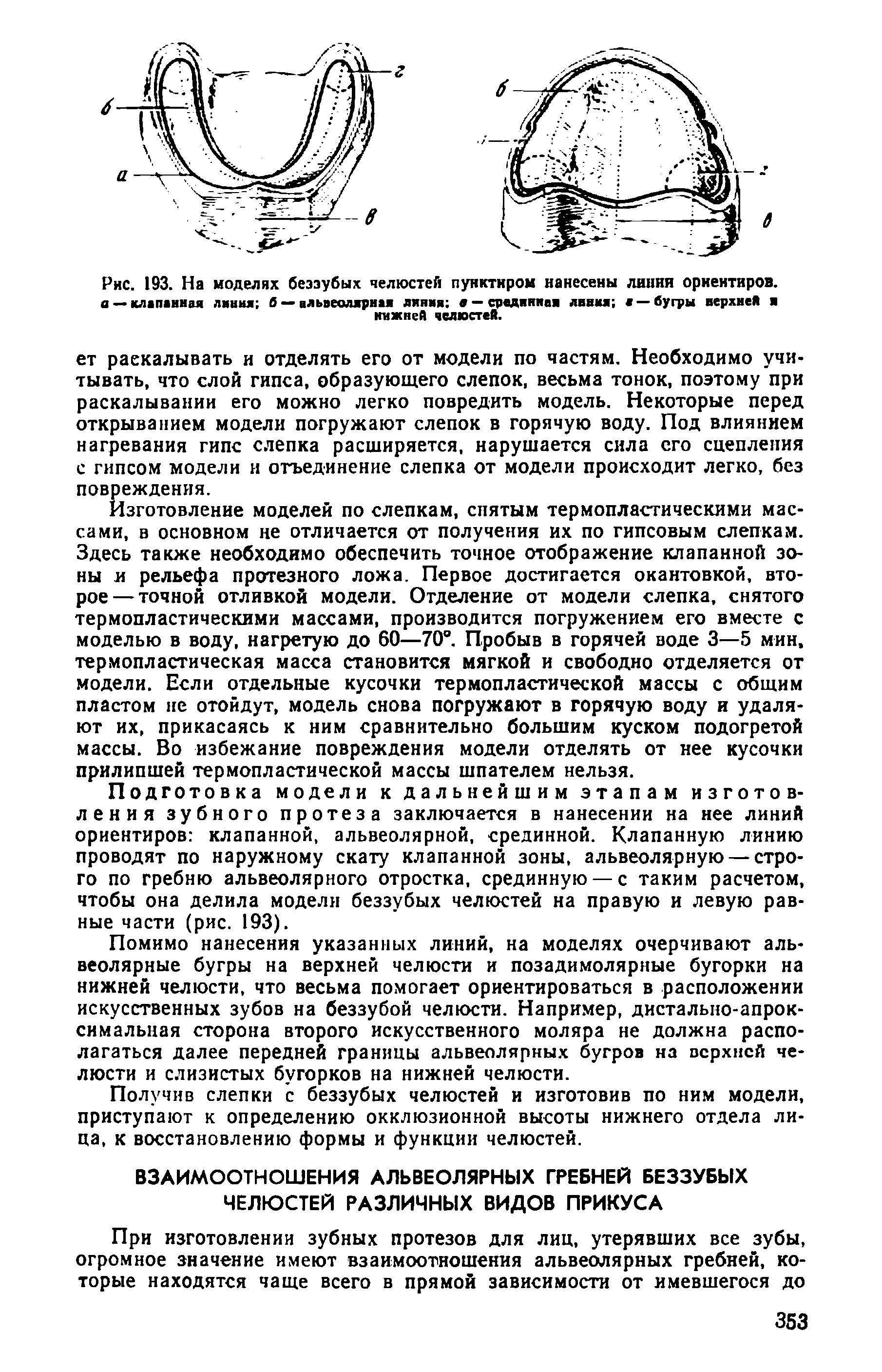 Рис. 193. На моделях беззубых челюстей пунктиром нанесены линии ориентиров. а — клапанная линия В — альвеолярная линия — срединной линия я —бугры верхней я нижней челюстей.