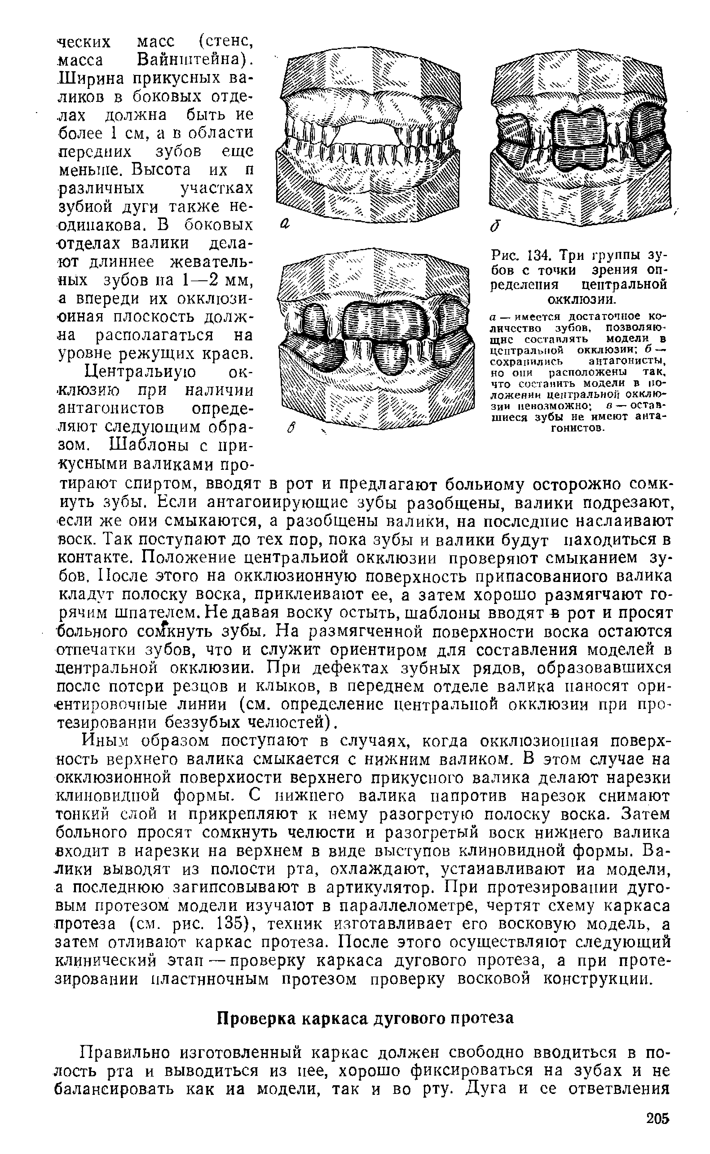 Рис. 134. Три группы зубов с точки зрения определения центральной окклюзии.