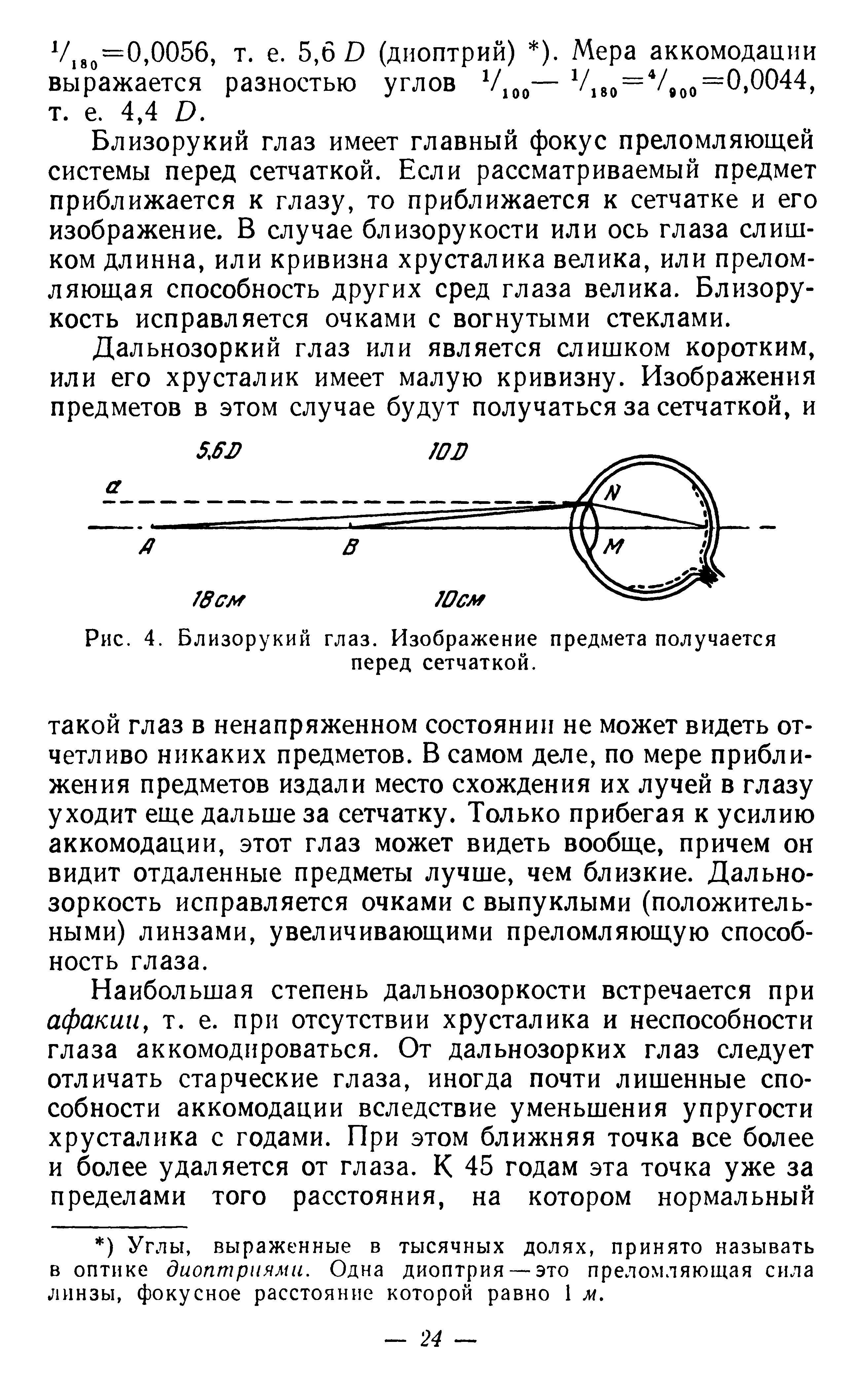 Рис. 4. Близорукий глаз. Изображение предмета получается перед сетчаткой.