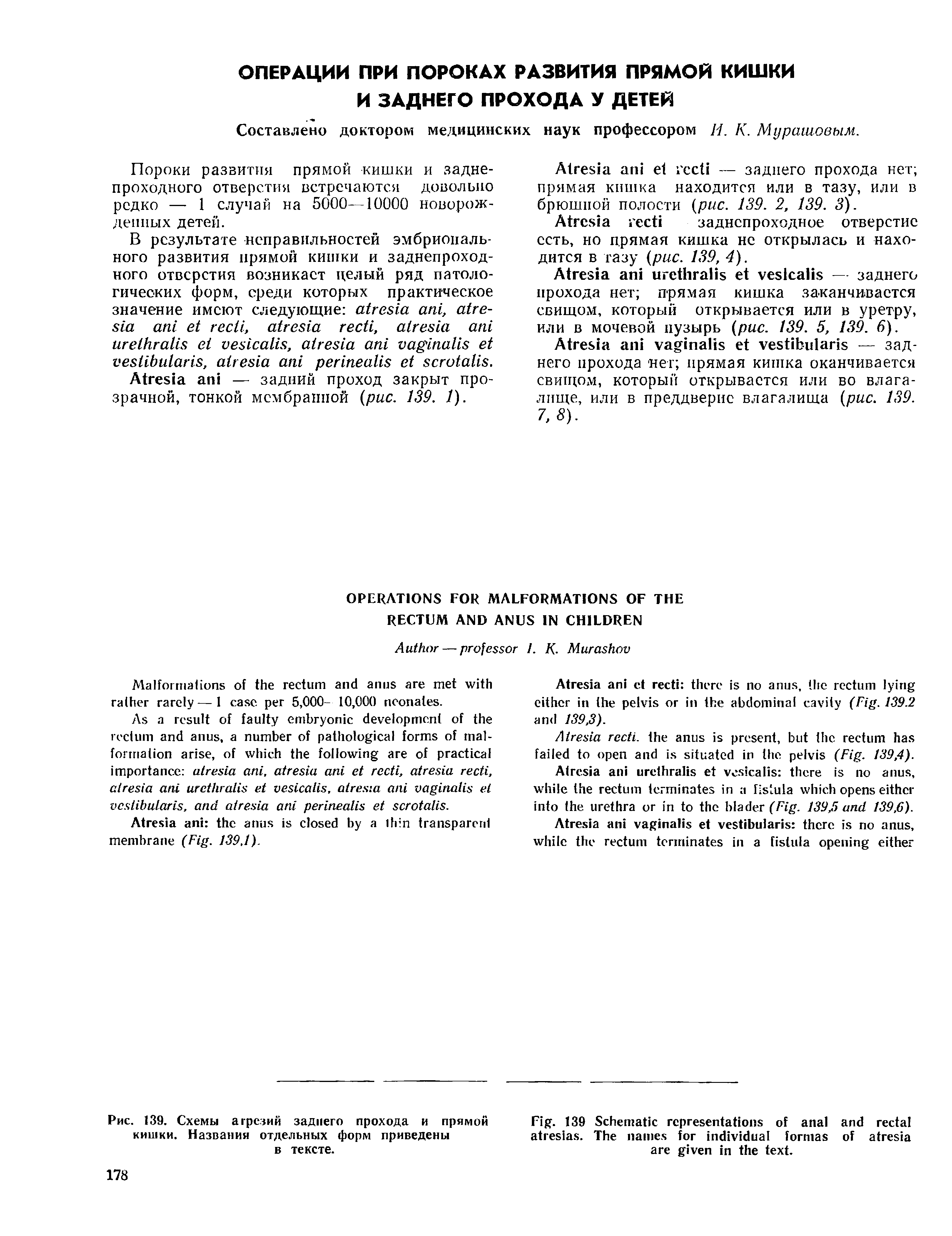 Рис. 139. Схемы атрезий заднего прохода и прямой кишки. Названия отдельных форм приведены в тексте.