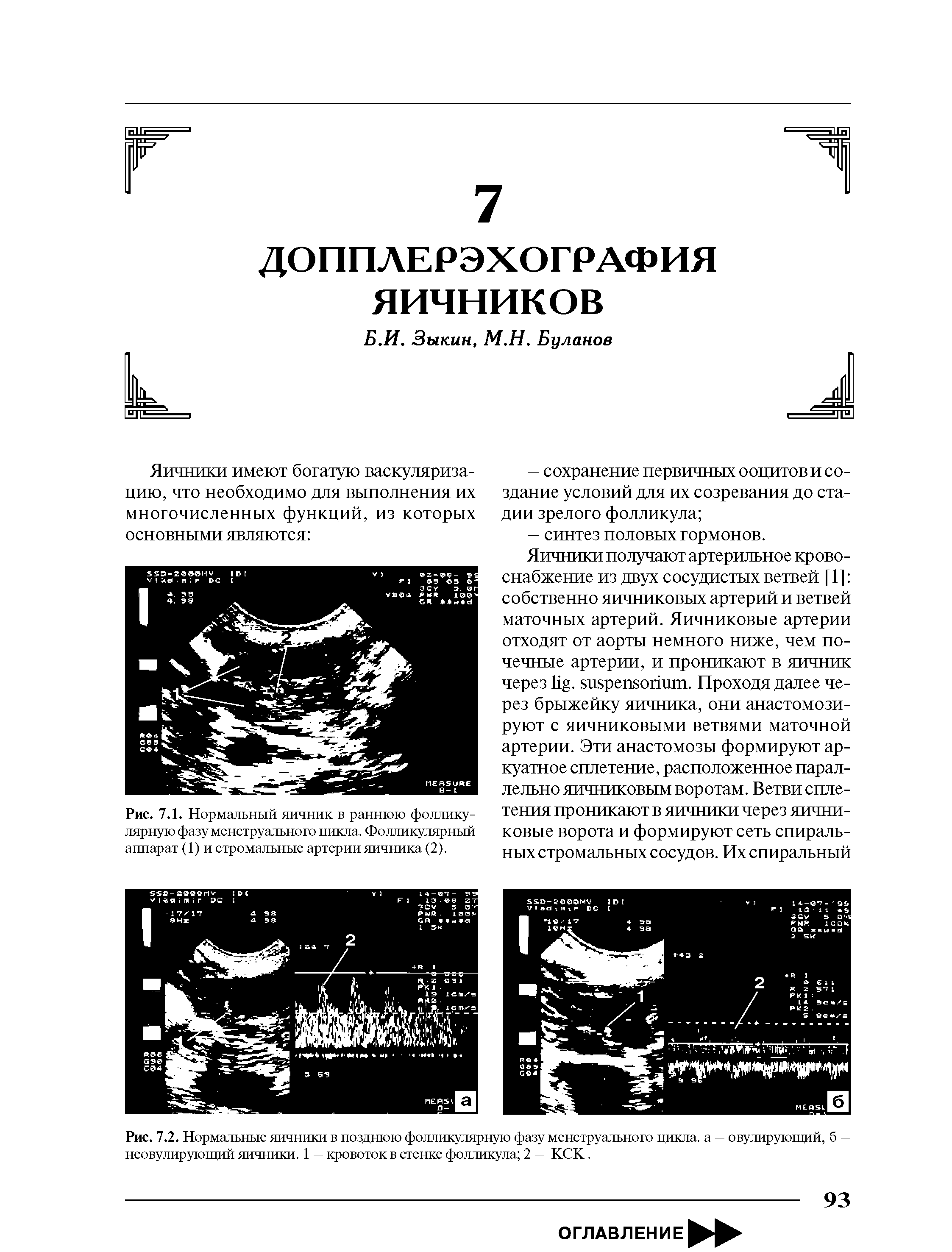 Рис. 7.1. Нормальный яичник в раннюю фолликулярную фазу менструального цикла. Фолликулярный аппарат (1) и стромальные артерии яичника (2).