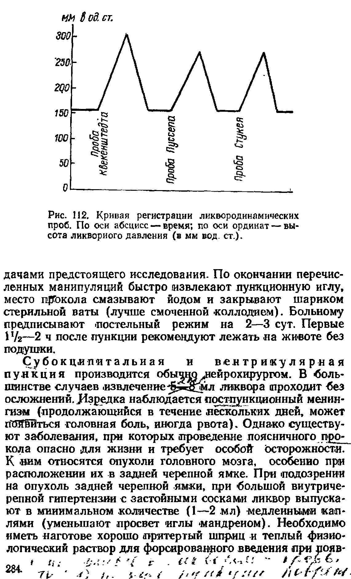 Рис. 112. Кривая регистрации ликвородинамических проб. По оси абсцисс — время по оси ординат — высота ликворного давления (в мм вод. ст.).