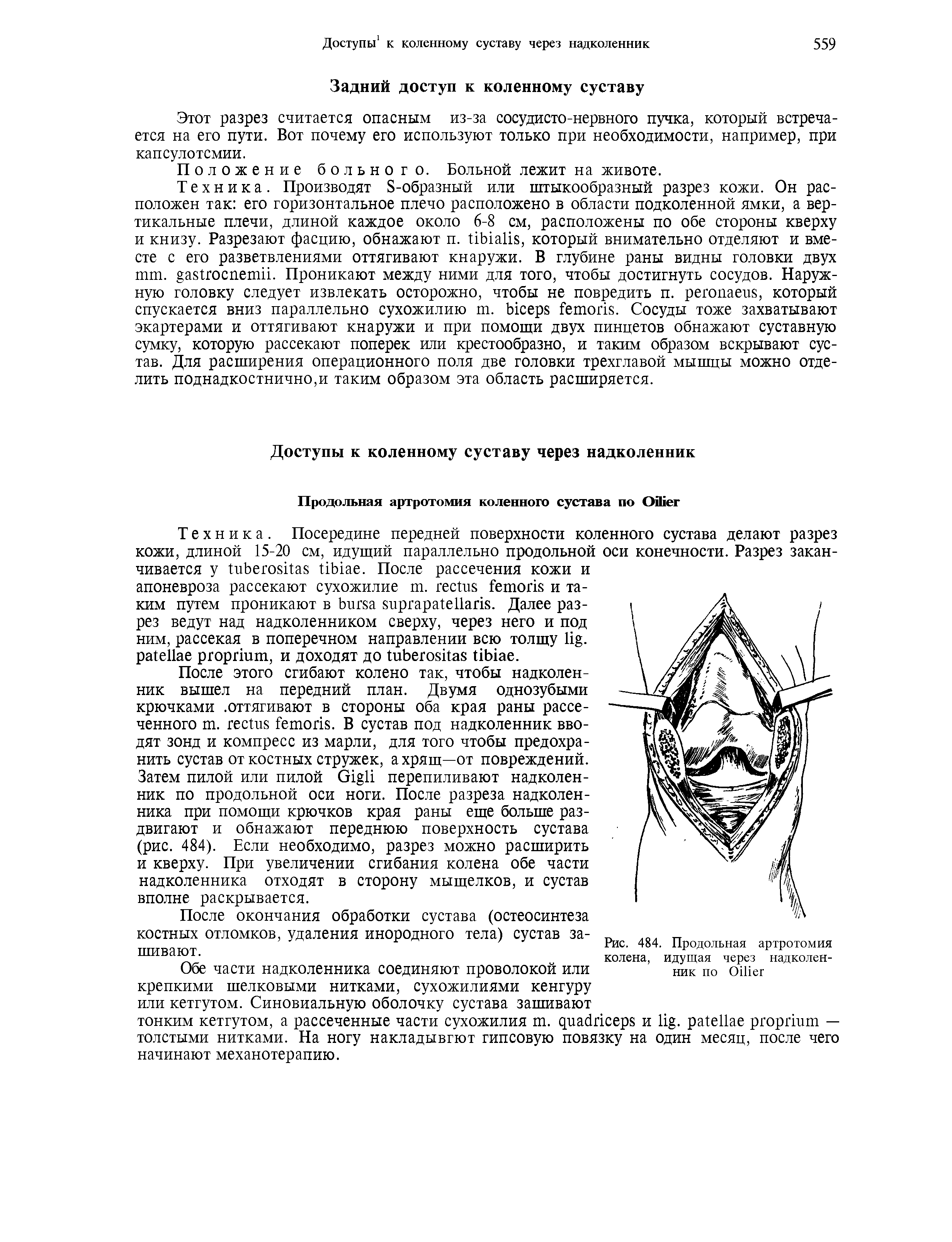 Рис. 484. Продольная артротомия колена, идущая через надколенник по O ...