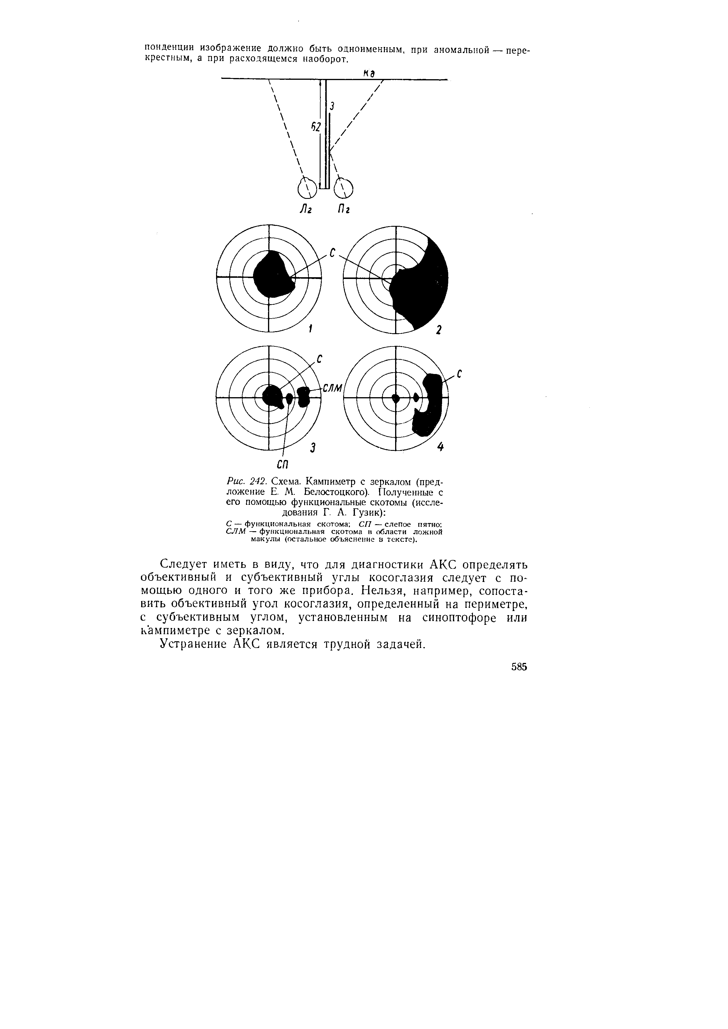 Рис. 242. Схема. Кампиметр с зеркалом (предложение Е. М. Белостоцкого). Полученные с его помощью функциональные скотомы (исследования Г. А. Гузик) ...