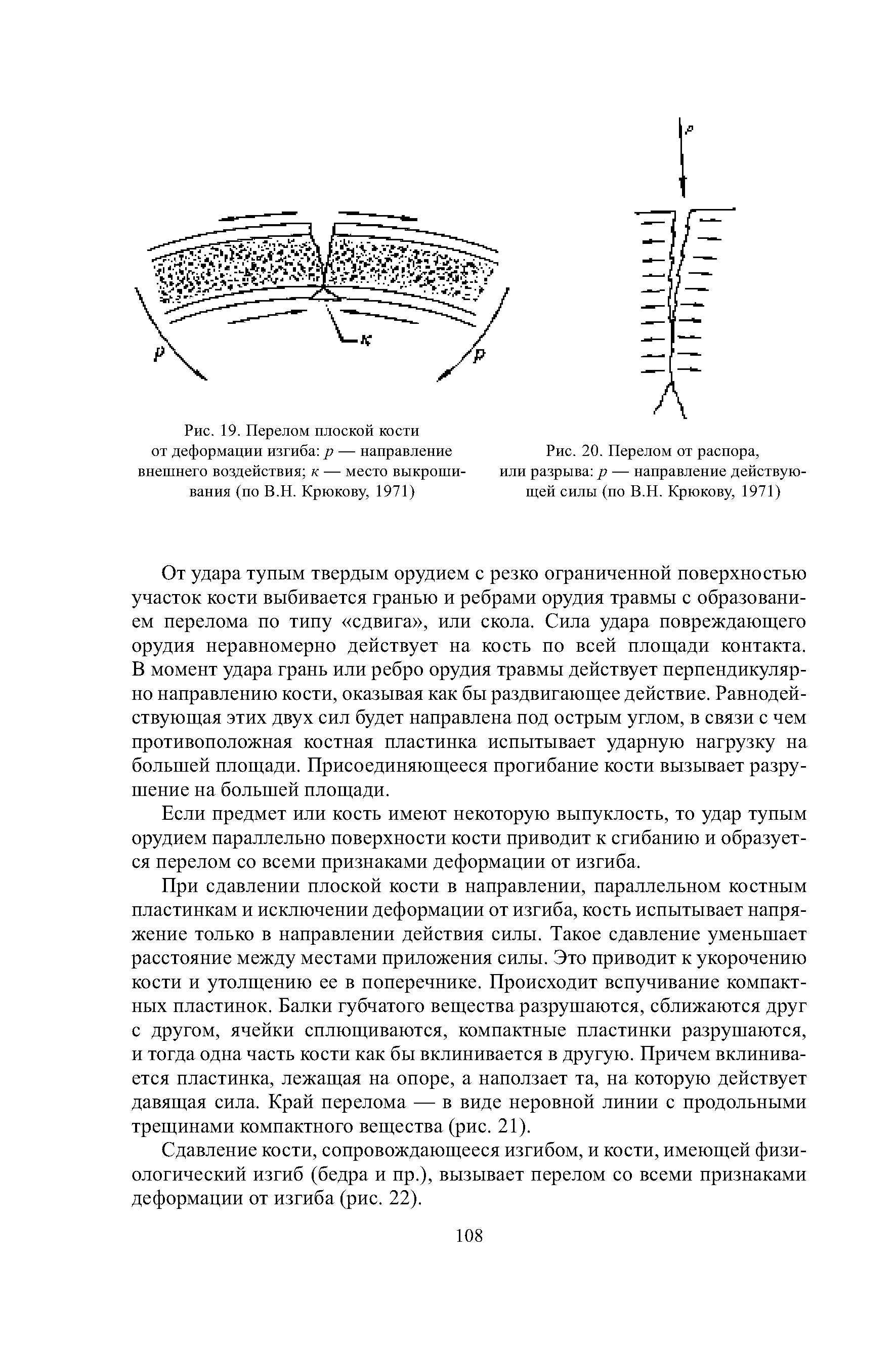 Рис. 19. Перелом плоской кости от деформации изгиба р — направление внешнего воздействия к — место выкроши-вания (по В.Н. Крюкову, 1971)...