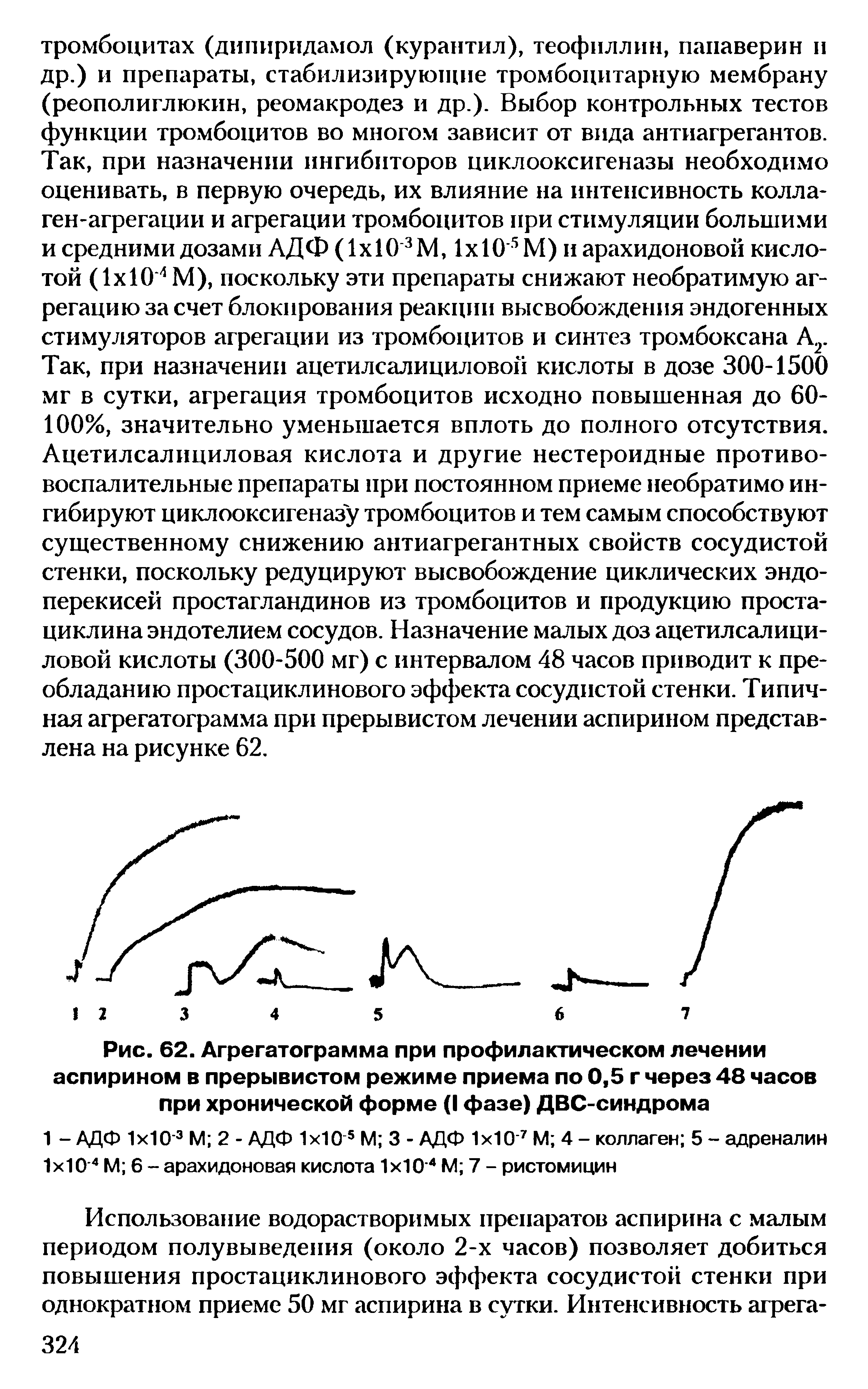 Рис. 62. Агрегатограмма при профилактическом лечении аспирином в прерывистом режиме приема по 0,5 г через 48 часо при хронической форме (I фазе) ДВС-синдрома...