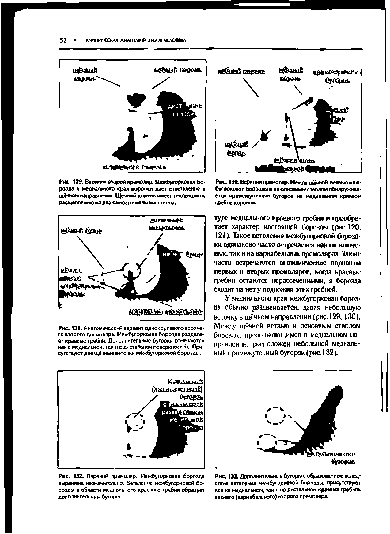 Рис. 132. Верхний премоляр. Межбугорковая борозда выражена незначительно. Ветвление межбугорковой борозды в области медивльного краевого гребня образует дополнительный бугорок.