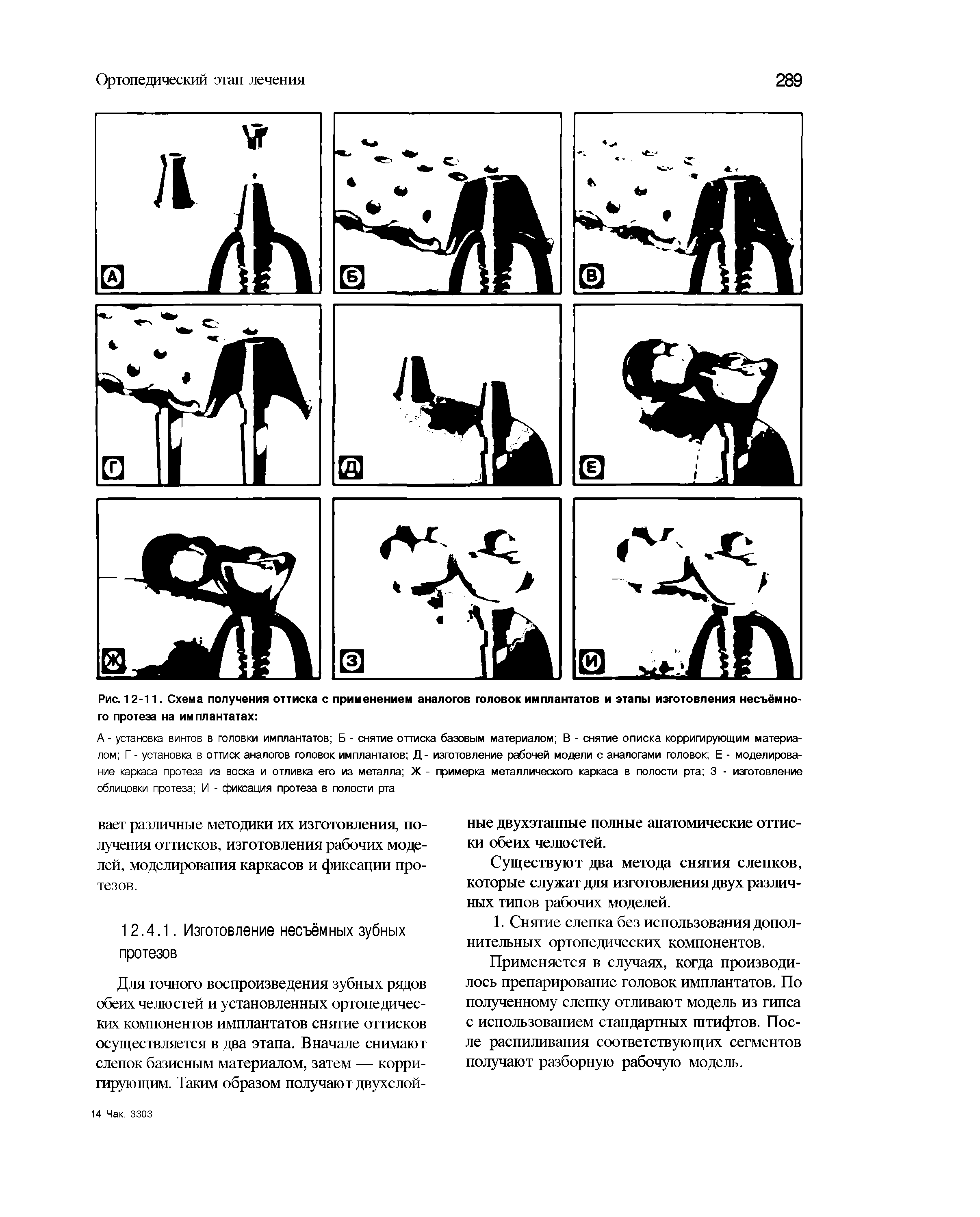 Рис. 12-11. Схема получения оттиска с применением аналогов головок имплантатов и этапы изготовления несъёмного протеза на имплантатах ...