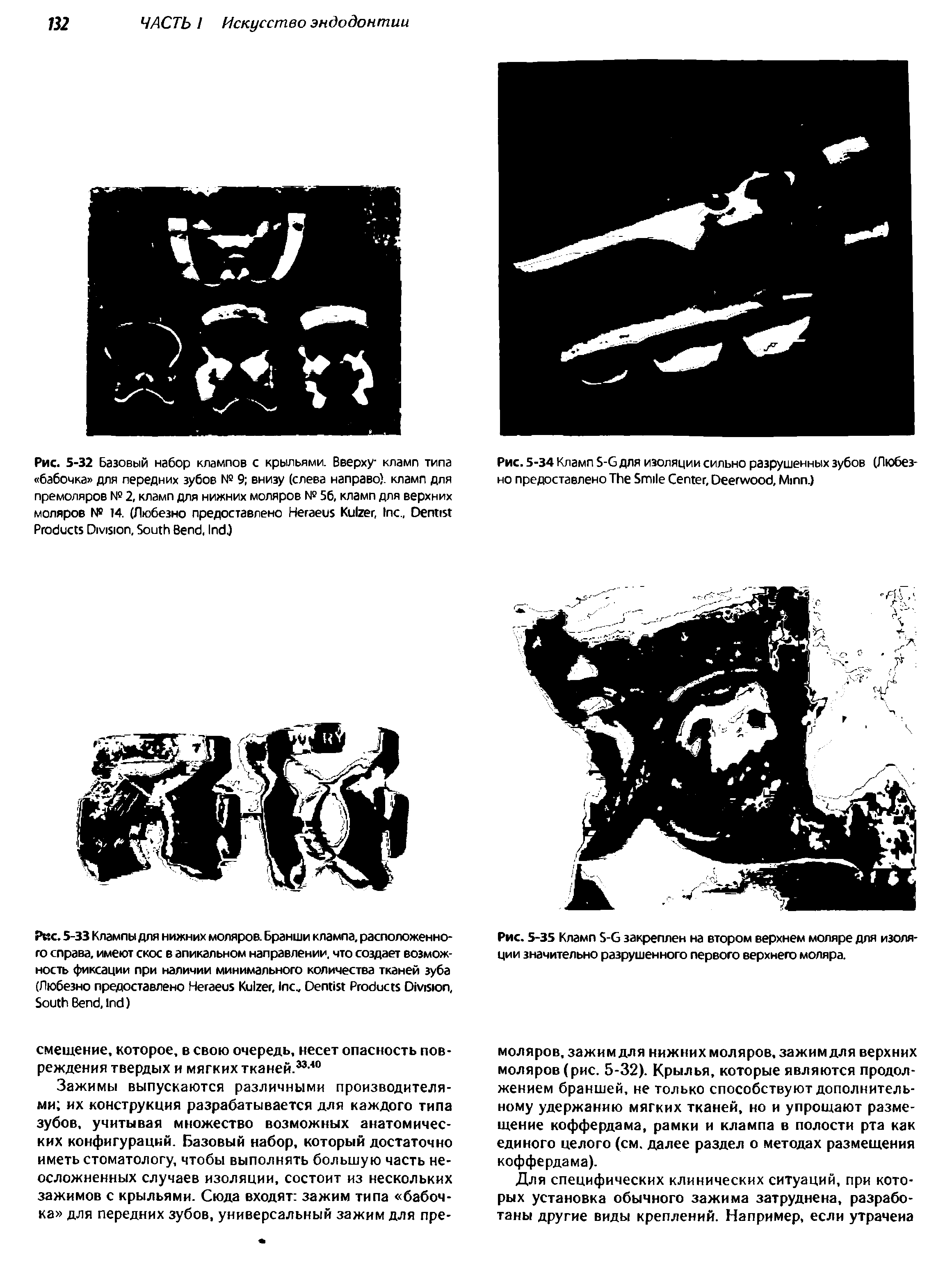 Рис. 5-34 Кламп S-G для изоляции сильно разрушенных зубов (Любезно предоставлено T S C , D , M .)...