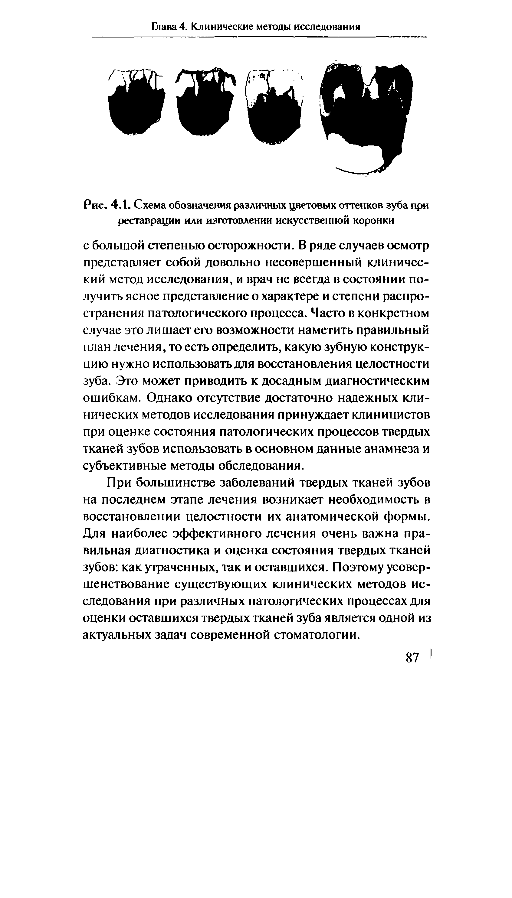 Рис. 4.1. Схема обозначения различных цветовых оттенков зуба при реставрации или изготовлении искусственной коронки...