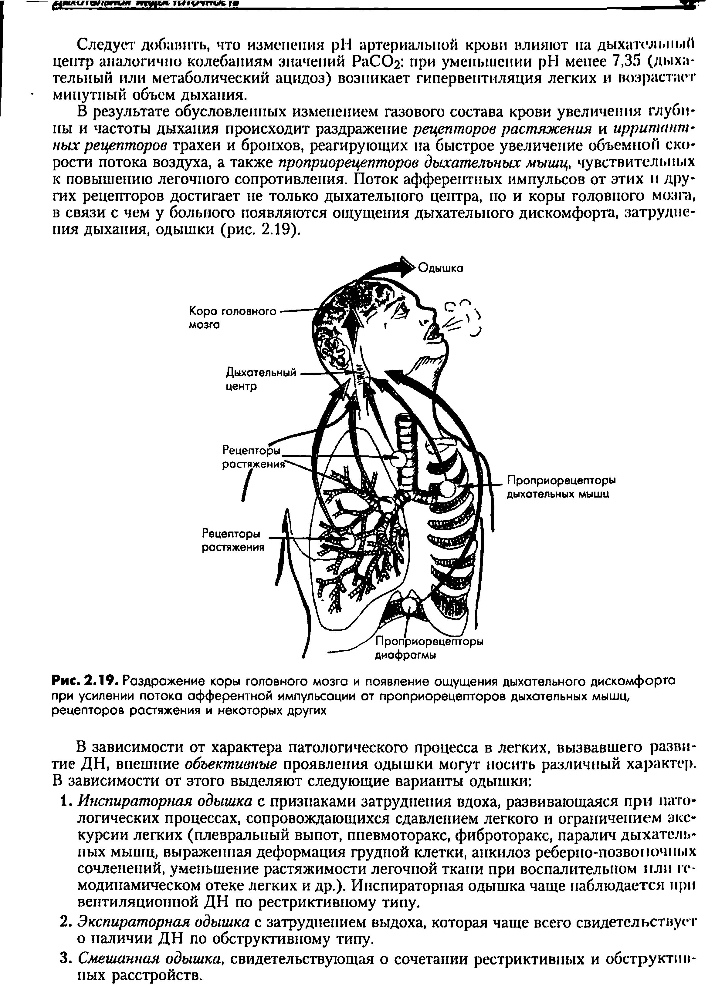 Рис. 2.19. Раздражение коры головного мозга и появление ощущения дыхательного дискомфорта при усилении потока афферентной импульсации от проприорецепторов дыхательных мышц, рецепторов растяжения и некоторых других...