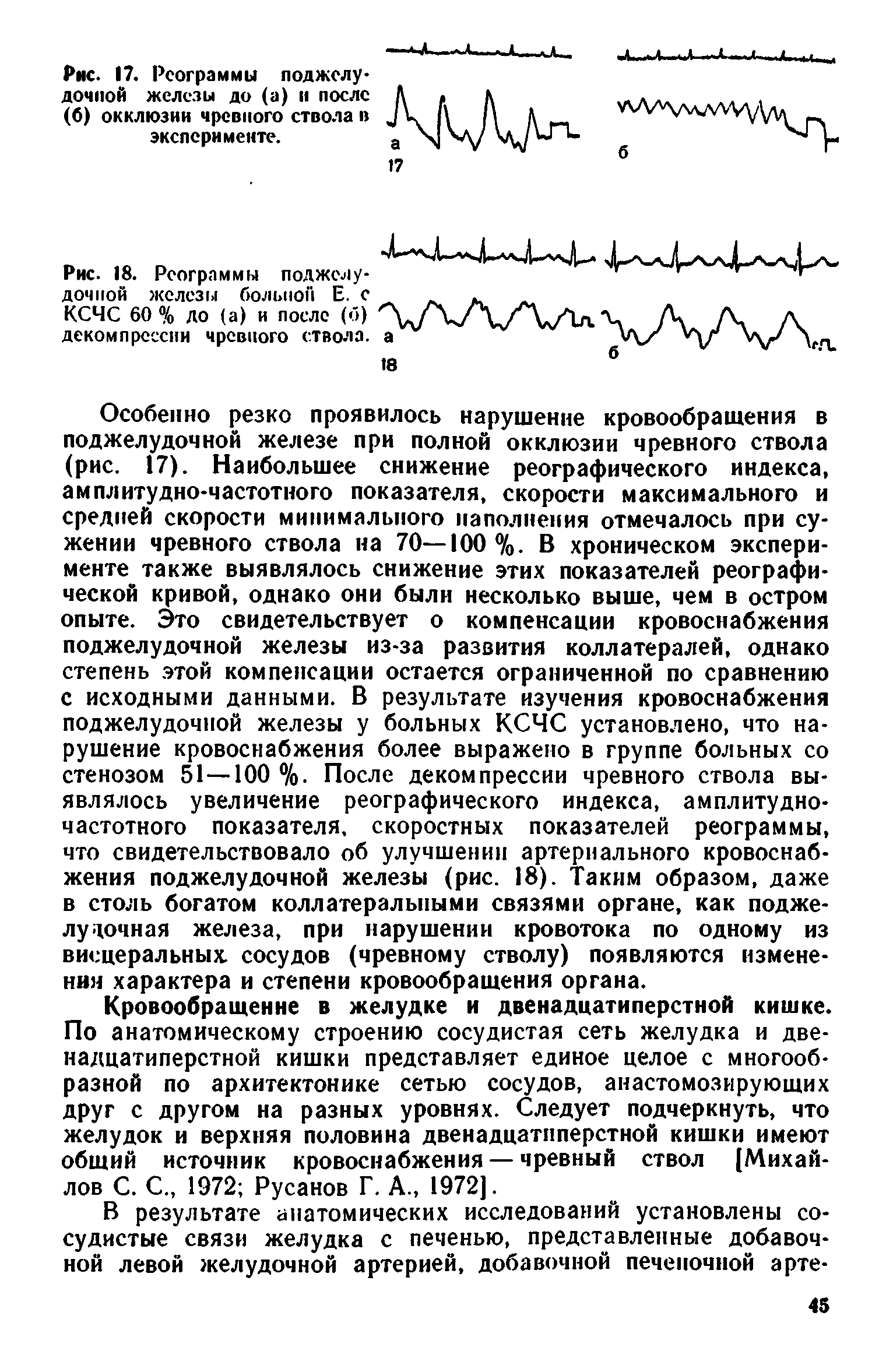 Рис. 17. Рсограммы поджелудочной железы до (а) и после (б) окклюзии чревного ствола в эксперименте.