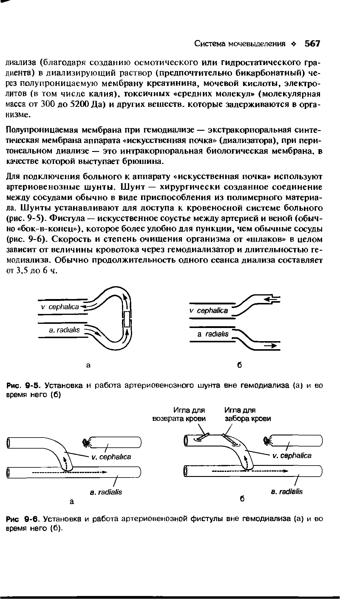 Рис. 9-5. Установка и работа артериовенозного шунта вне гемодиализа (а) и во время него (б)...