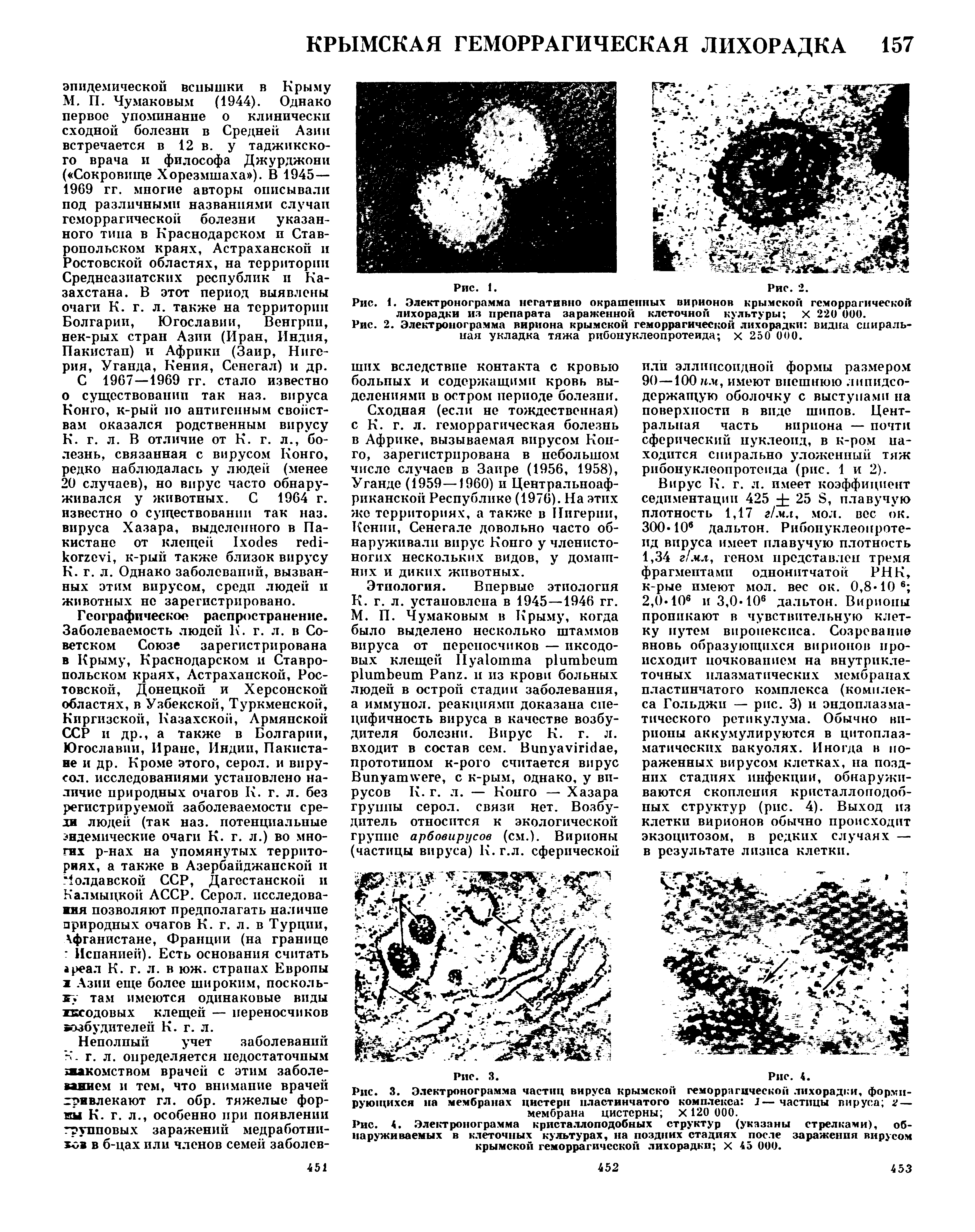 Рис. 3. Электронограмма частиц вируса крымской геморрагической лихорадки, формирующихся на мембранах цистерн пластинчатого комплекса 1— частицы вируса 2 — мембрана цистерны X 120 000.