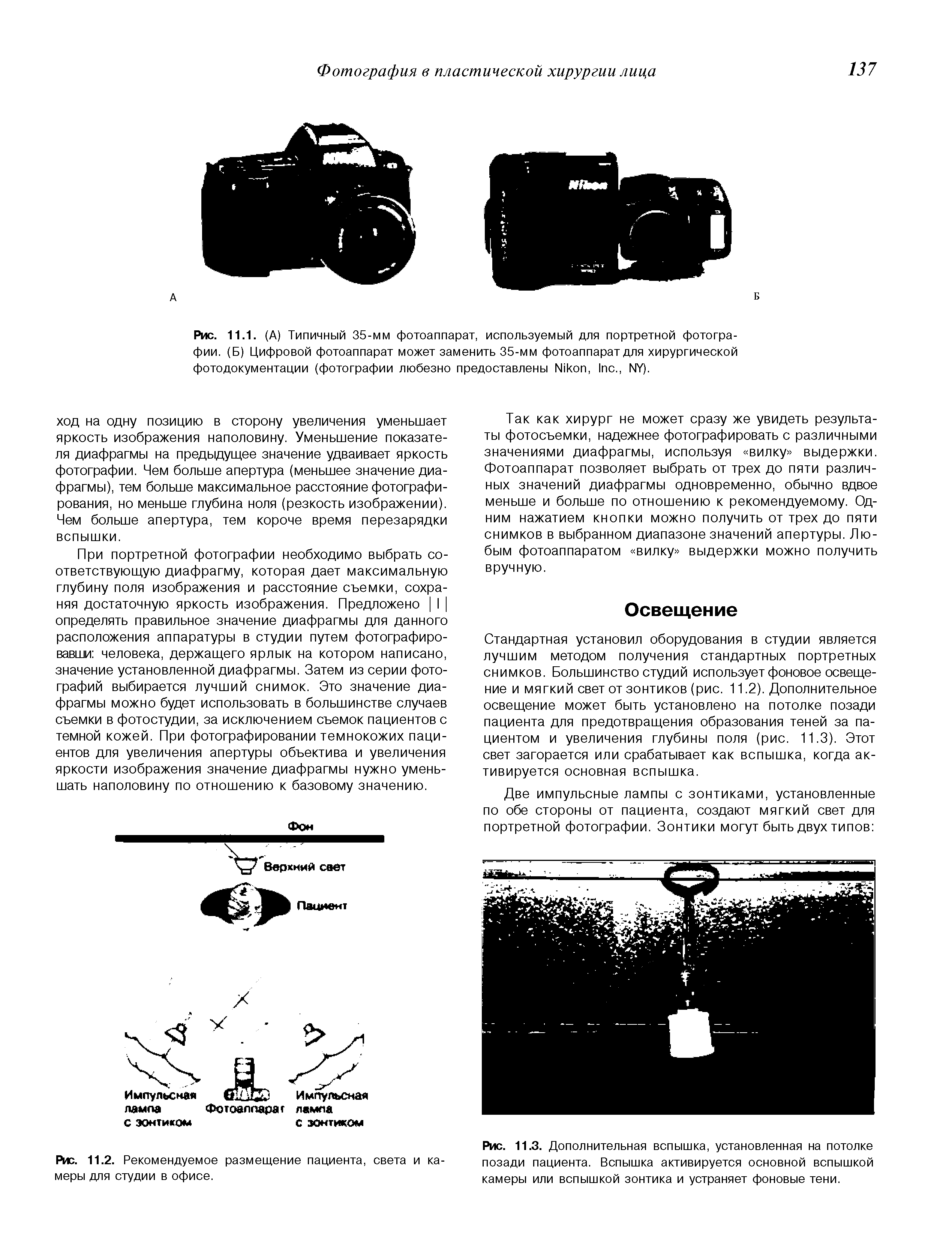 Рис. 11.1. (А) Типичный 35-мм фотоаппарат, используемый для портретной фотографии. (Б) Цифровой фотоаппарат может заменить 35-мм фотоаппарат для хирургической фотодокументации (фотографии любезно предоставлены N , I ., NY).