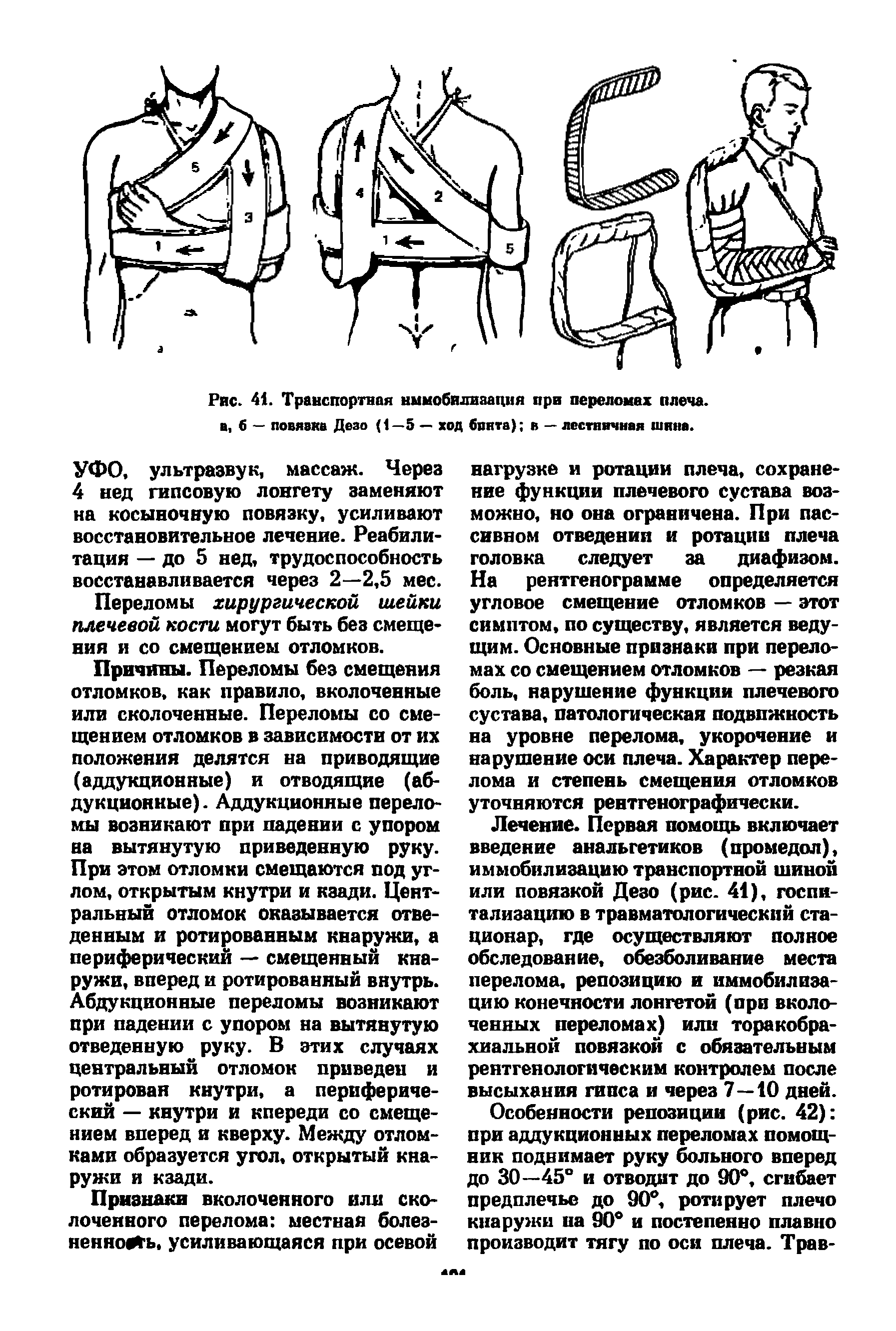 Рис. 41. Транспортная иммобилизация при переломах плеча, а, б — повязка Дезо (1—5 — ход банта) в — лестничная шнна.