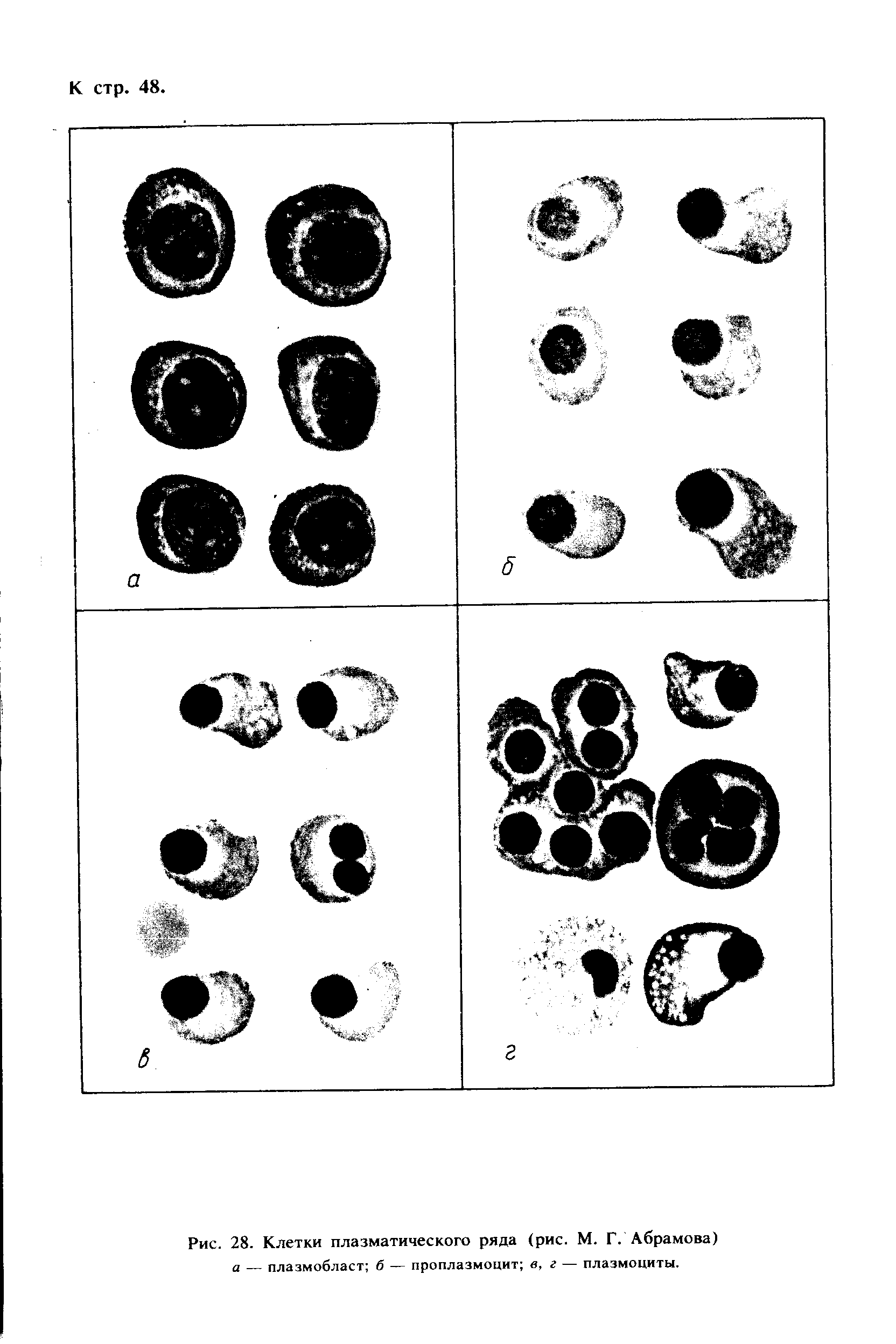 Рис. 28. Клетки плазматического ряда (рис. М. Г. Абрамова) а — плазмобласт б — проплазмоцит в, г — плазмоциты.