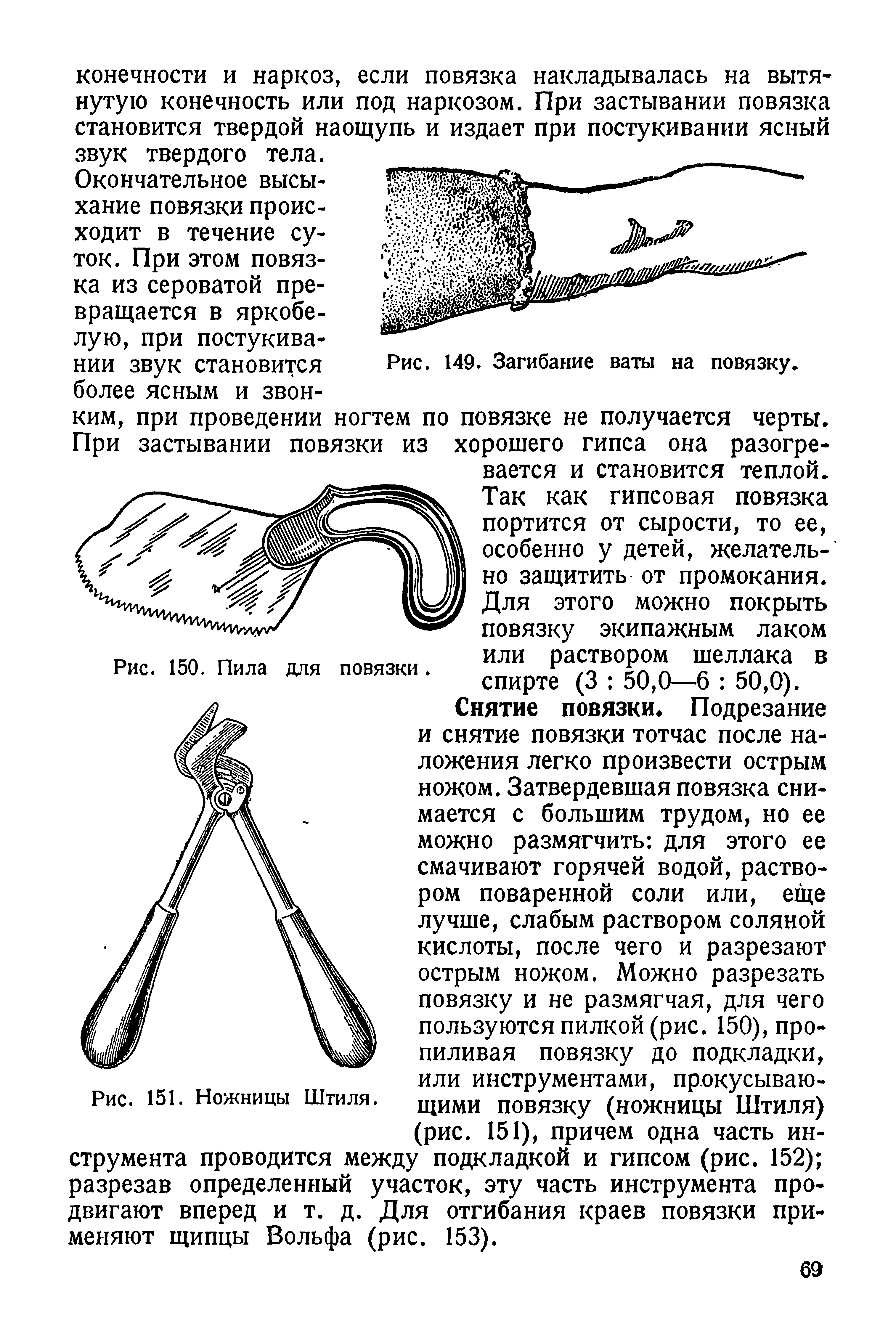 Рис. 151. Ножницы Штиля. щИми повязку (ножницы Штиля) (рис. 151), причем одна часть инструмента проводится между подкладкой и гипсом (рис. 152) разрезав определенный участок, эту часть инструмента продвигают вперед и т. д. Для отгибания краев повязки применяют щипцы Вольфа (рис. 153).