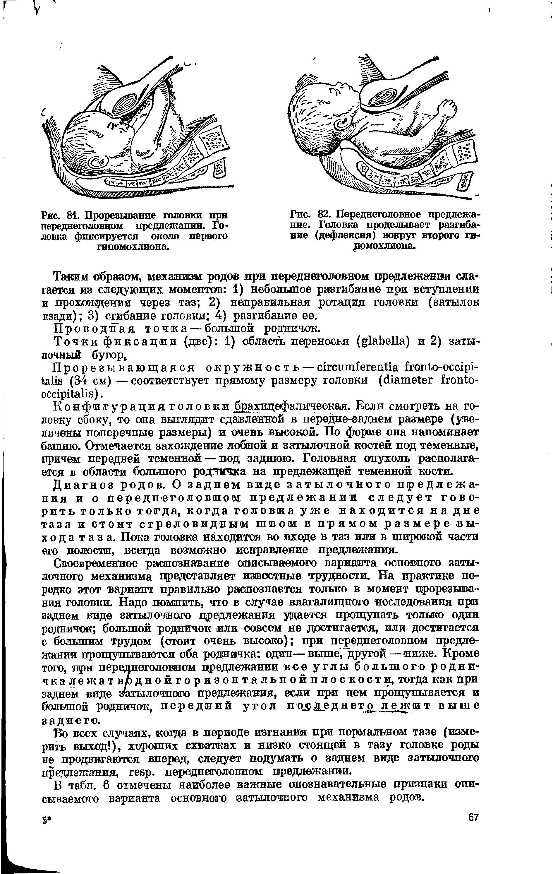 Рис. 81. Прорезывание головки при переднеголовцом предлежании. Головка фиксируется около первого гипомохлиона.