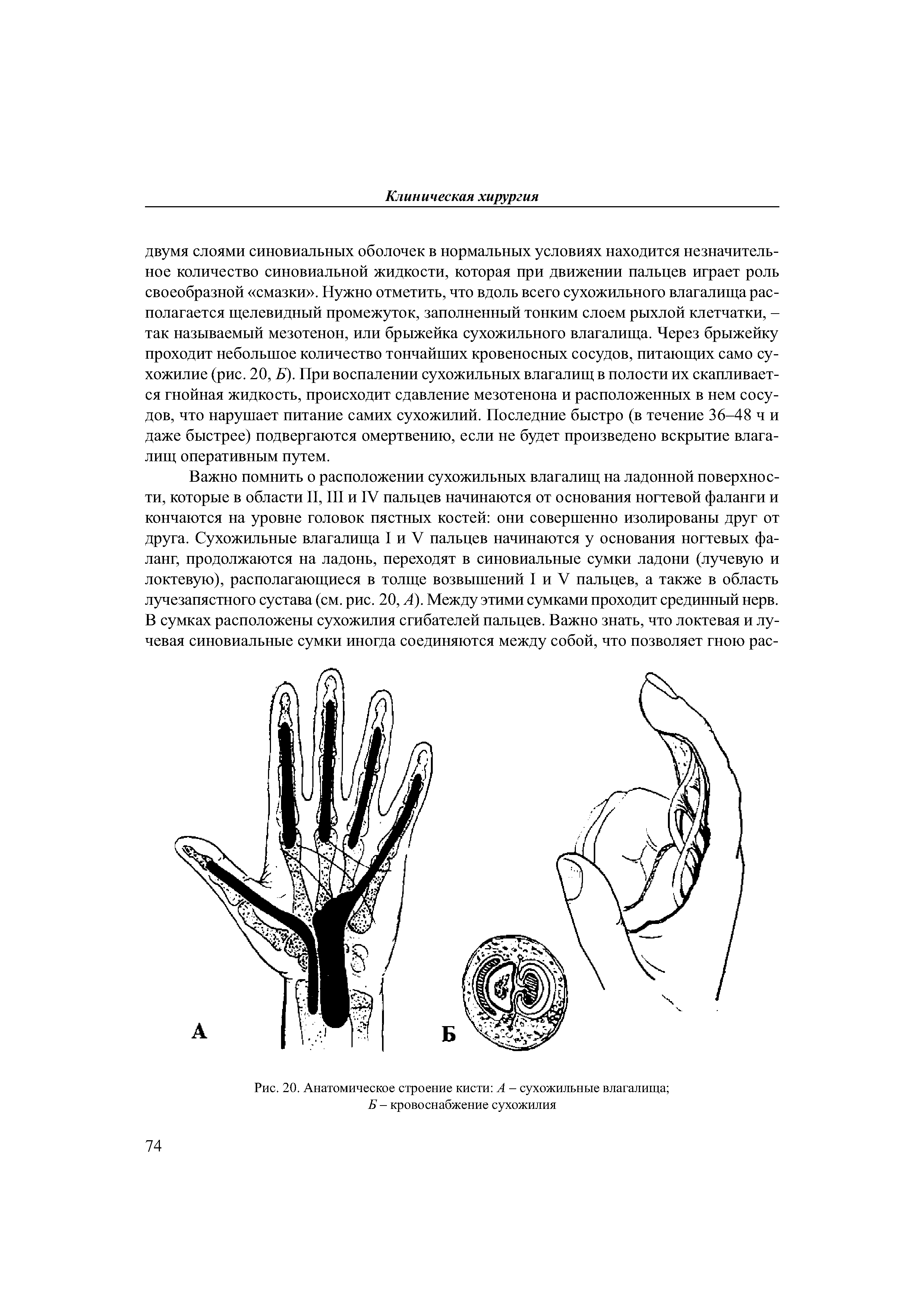Рис. 20. Анатомическое строение кисти А - сухожильные влагалища Б - кровоснабжение сухожилия...